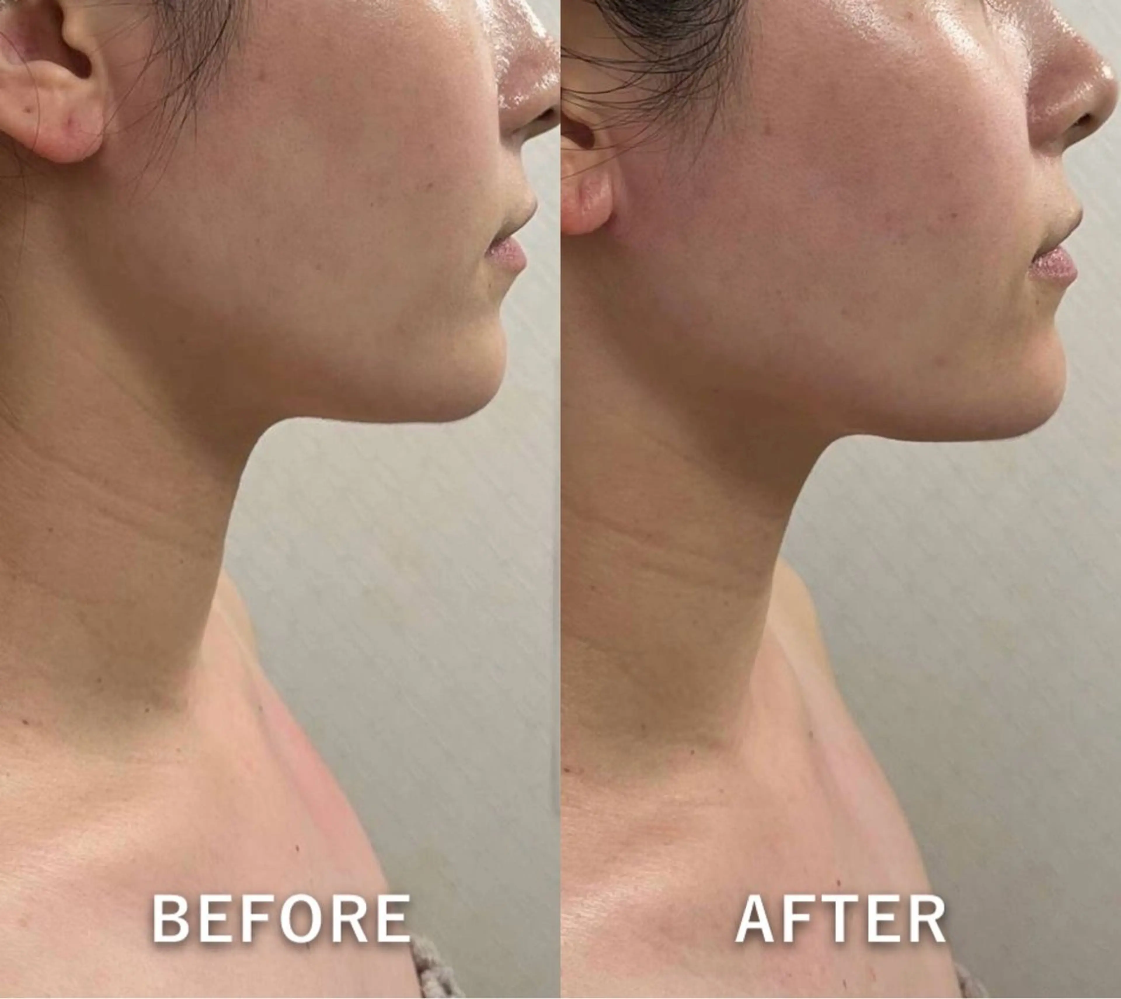 エステ 韓国美肌/肌質改善 【天神】のエステ・リラクイメージ