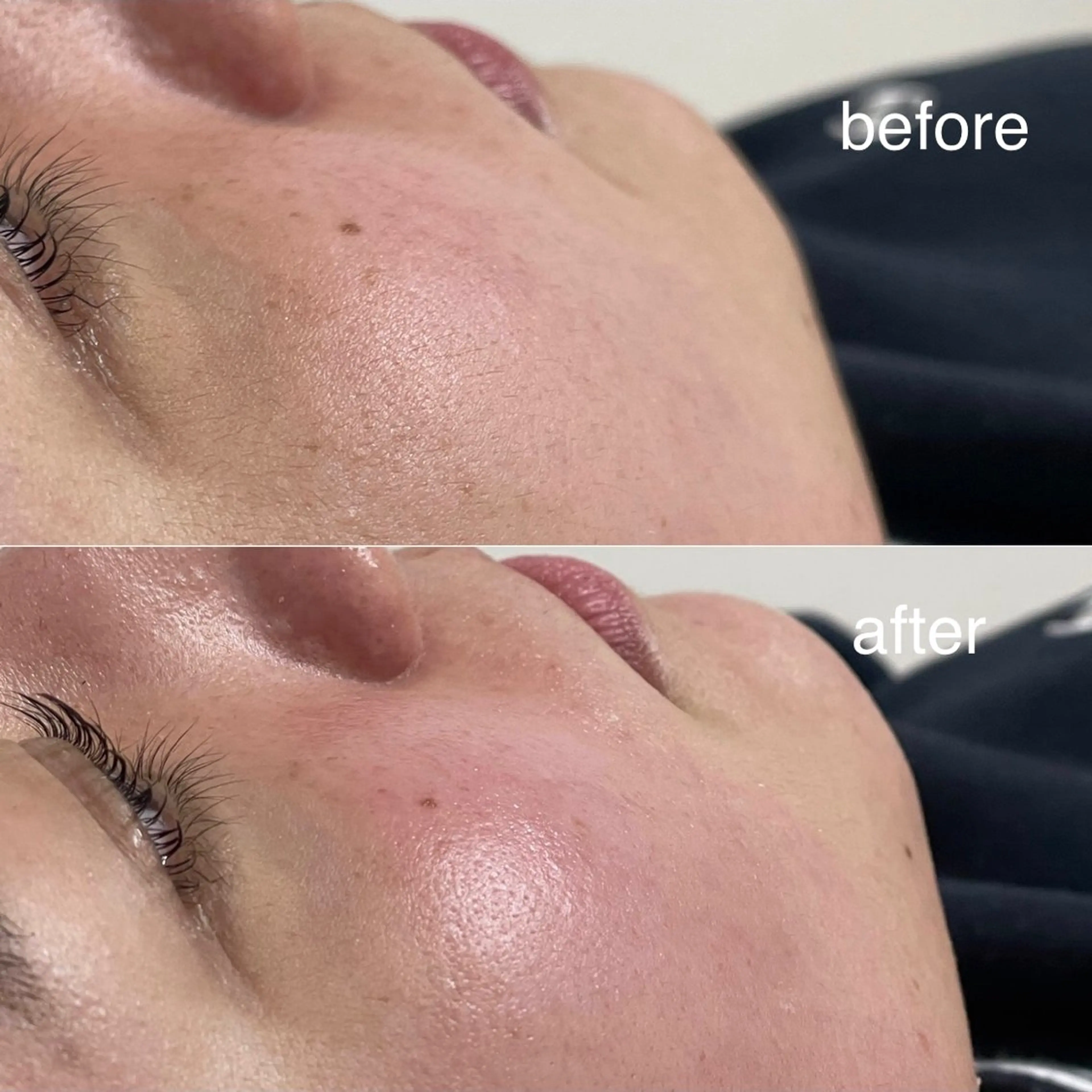 初回限定　フェイシャルワックスの写真