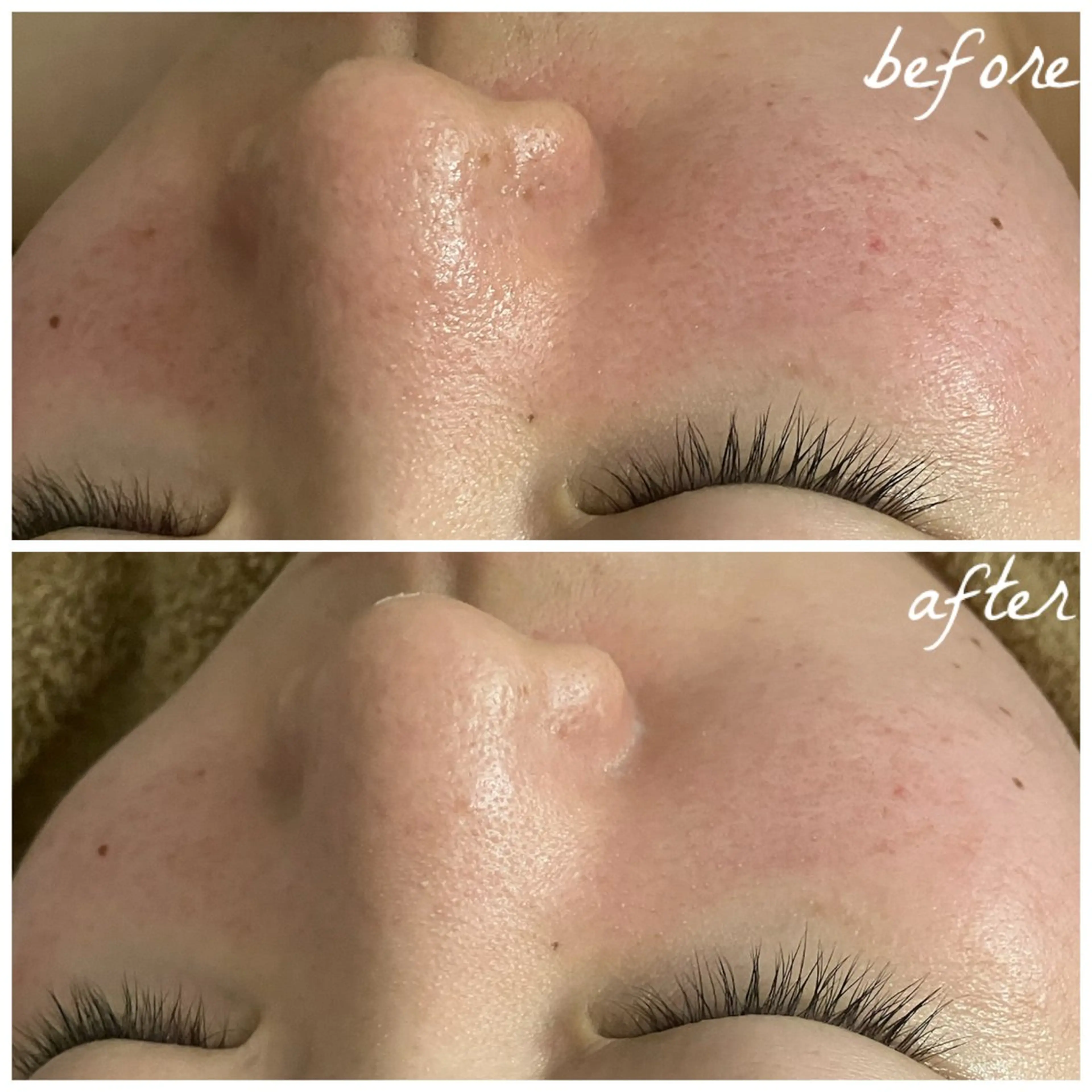 メンズ エステ メナード岐阜茜部 杉浦のエステ・リラクイメージ