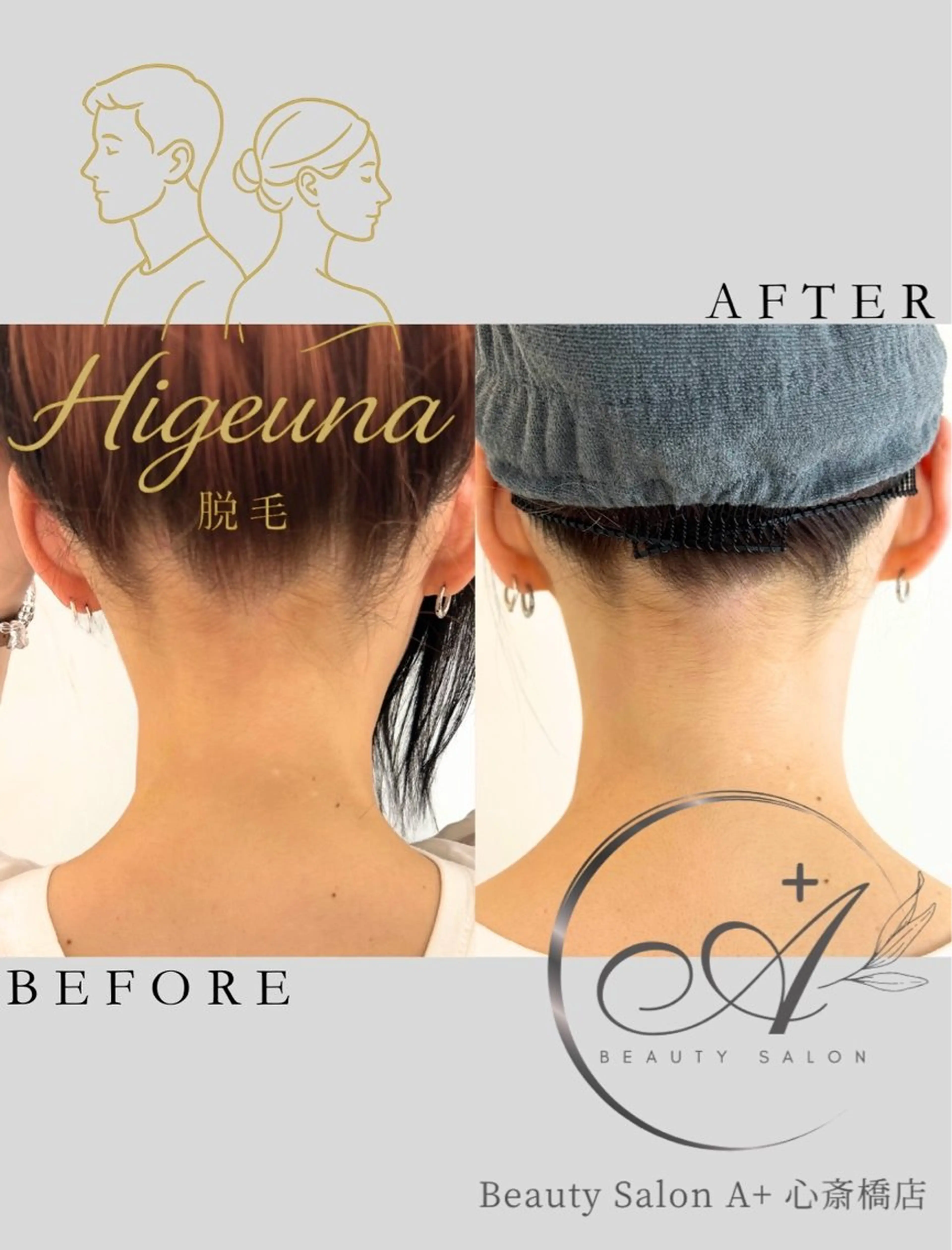 脱毛 うなじ脱毛/ つや肌ハーブのエステ・リラクイメージ