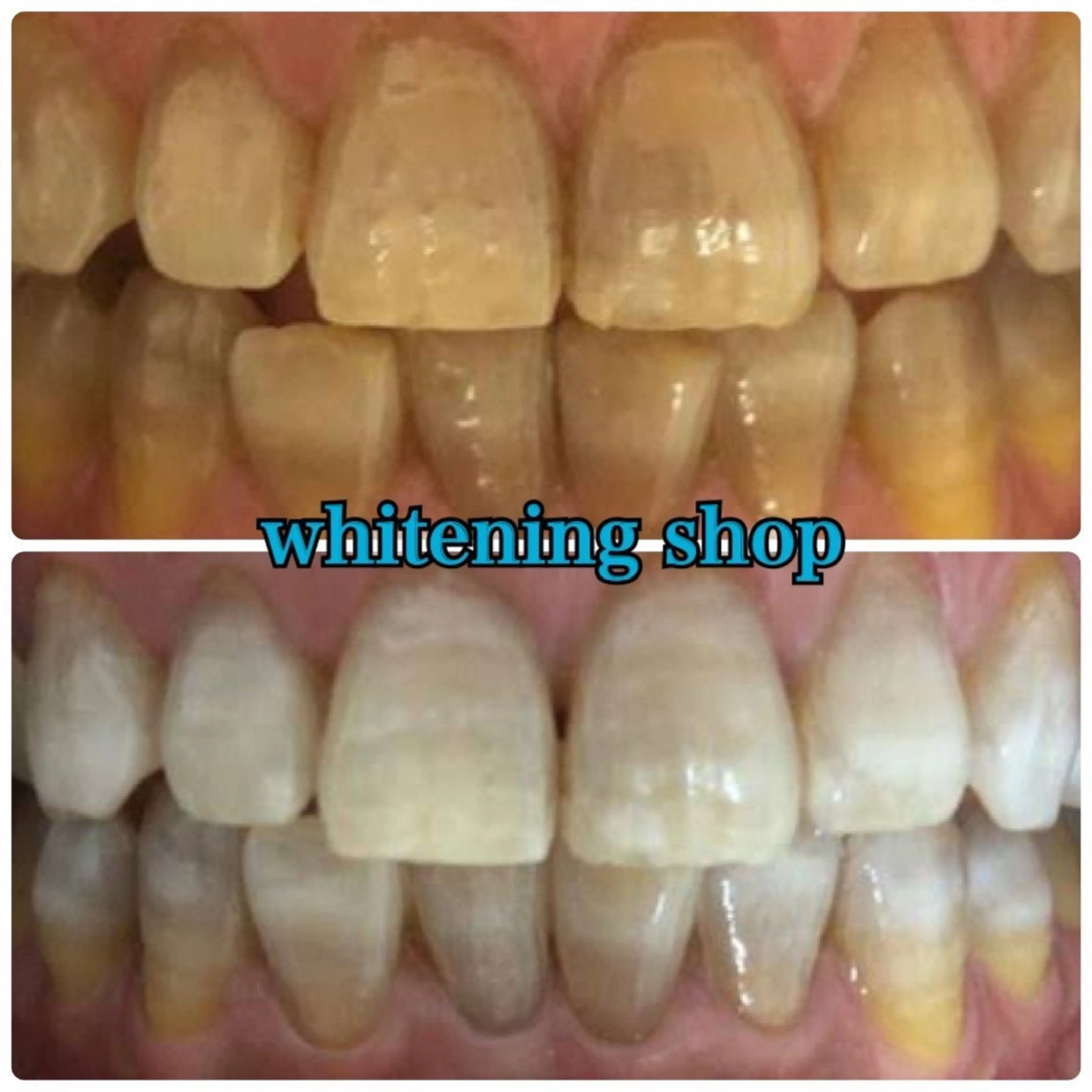 その他 ホワイトニング ショップ津店のその他イメージ