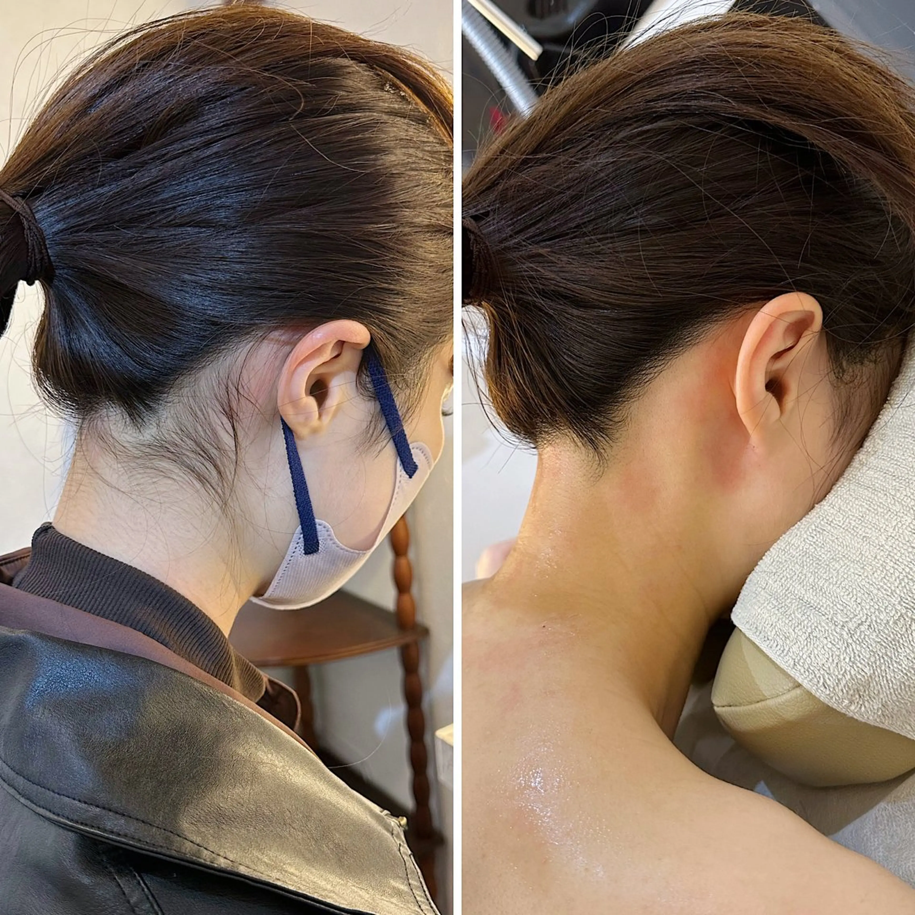 脱毛 うなじ脱毛/美肌脱毛 LABELのエステ・リラクイメージ