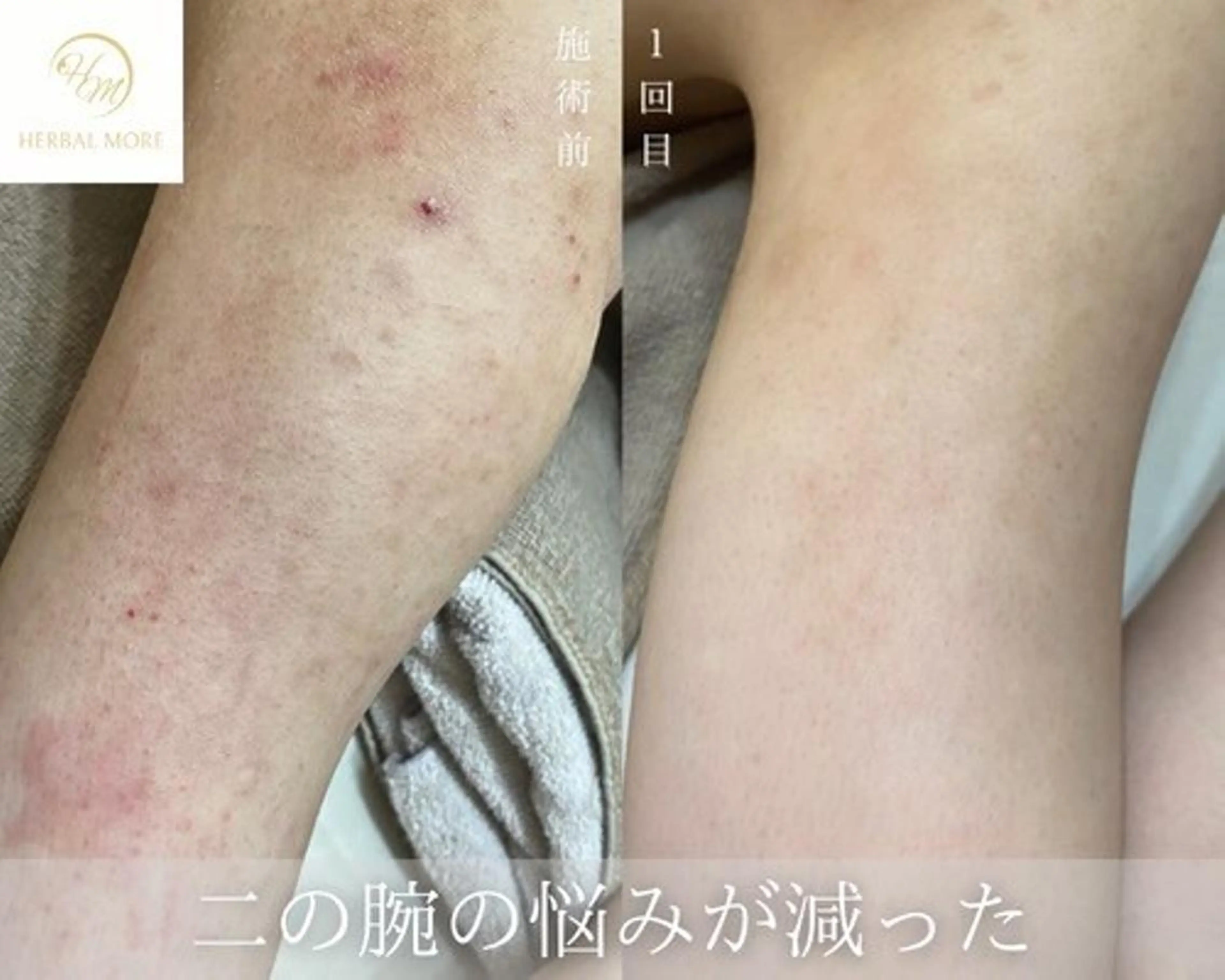 脱毛・眉毛・フェイス サロンN久留米店の眉毛・アイブロウイメージ