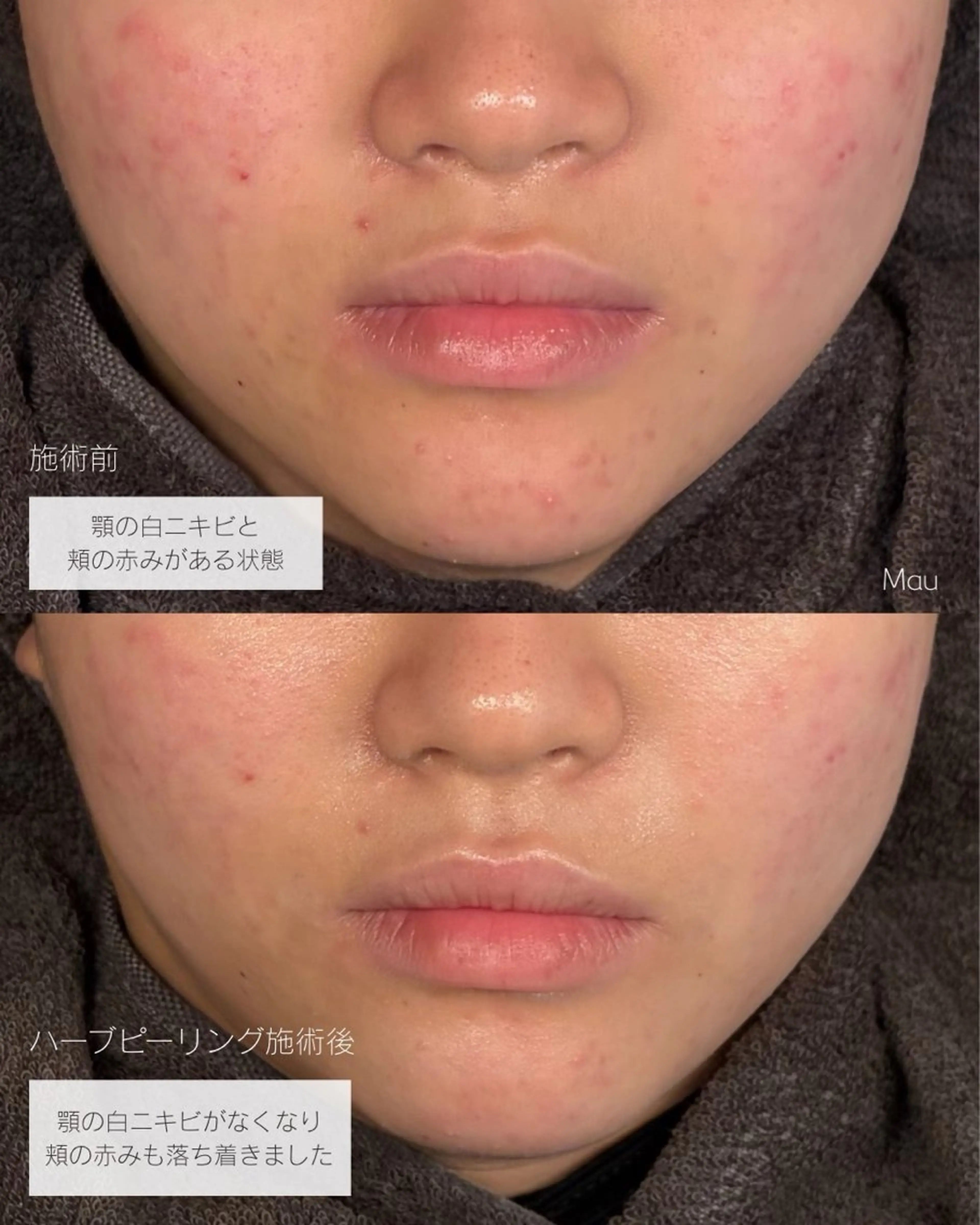 エステ リラク フェイシャルサロン -Mau-のエステ・リラクイメージ