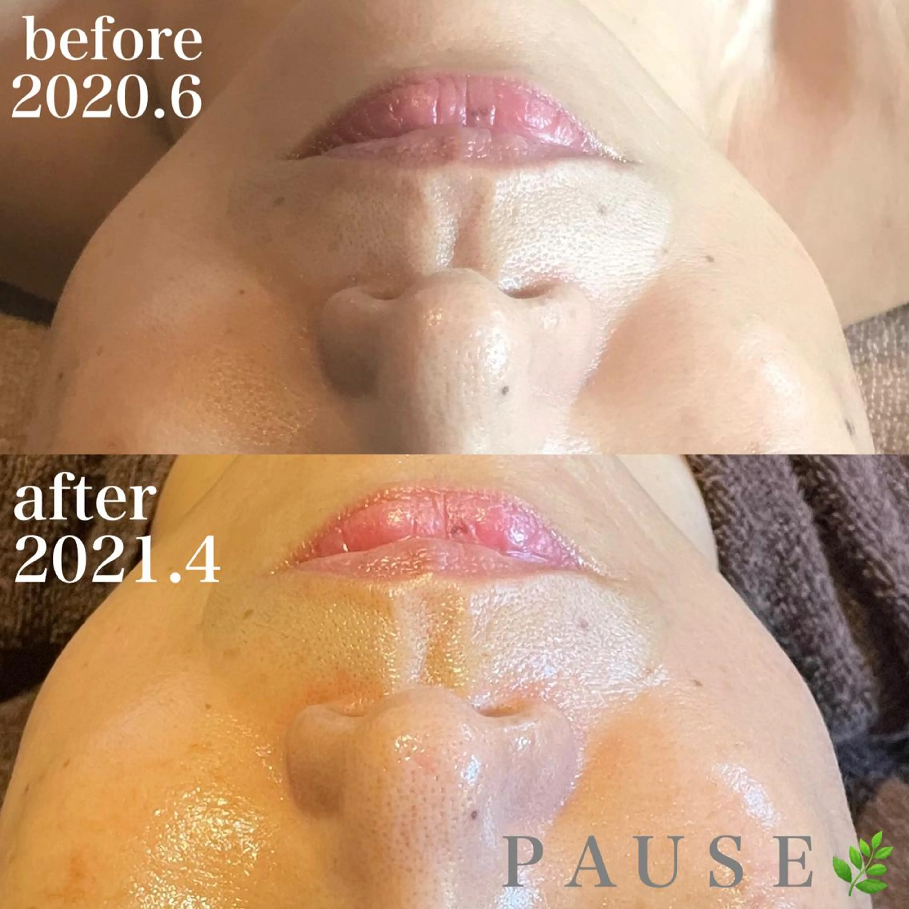 エステ 浜野 恵美のエステ・リラクイメージ