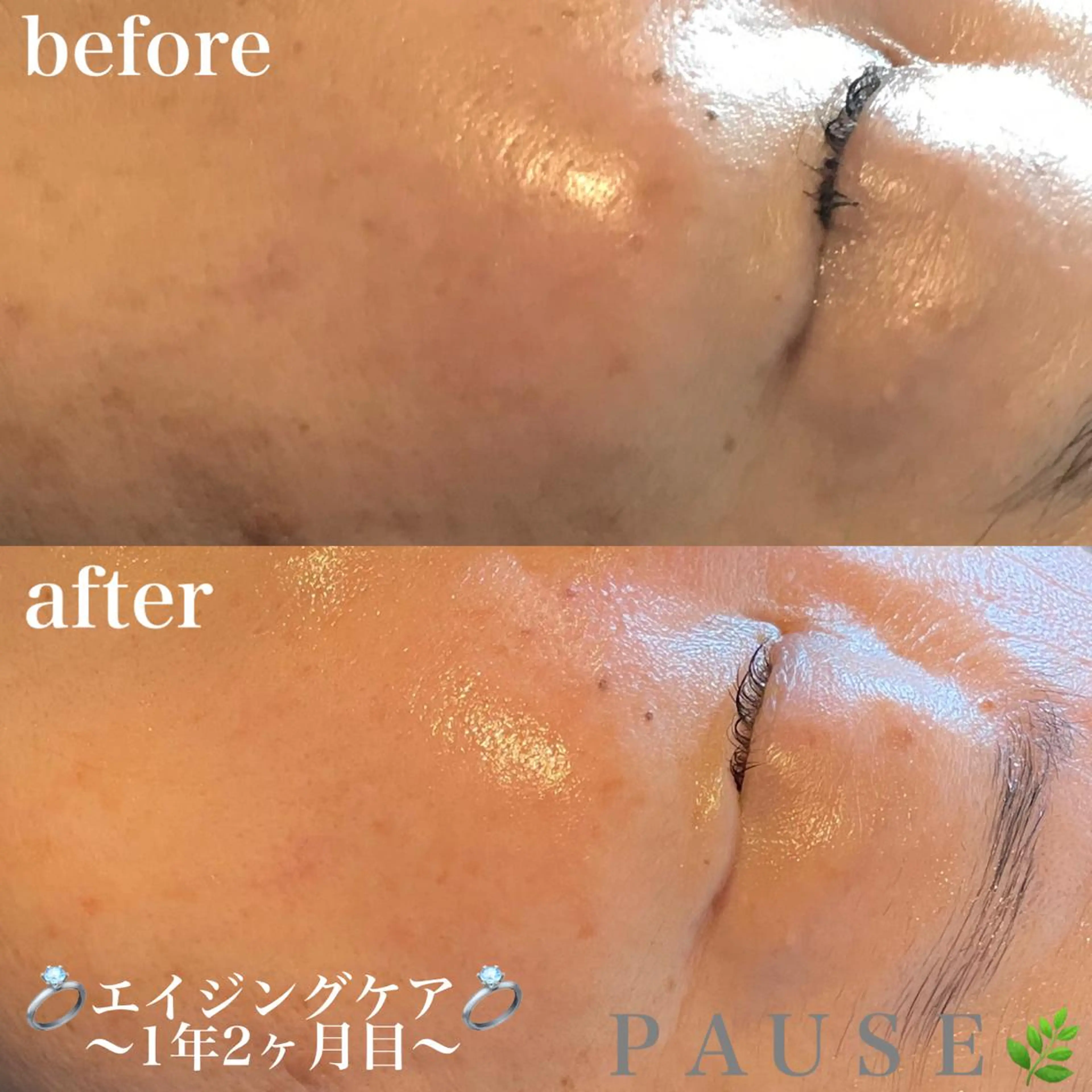 エステ 浜野 恵美のエステ・リラクイメージ