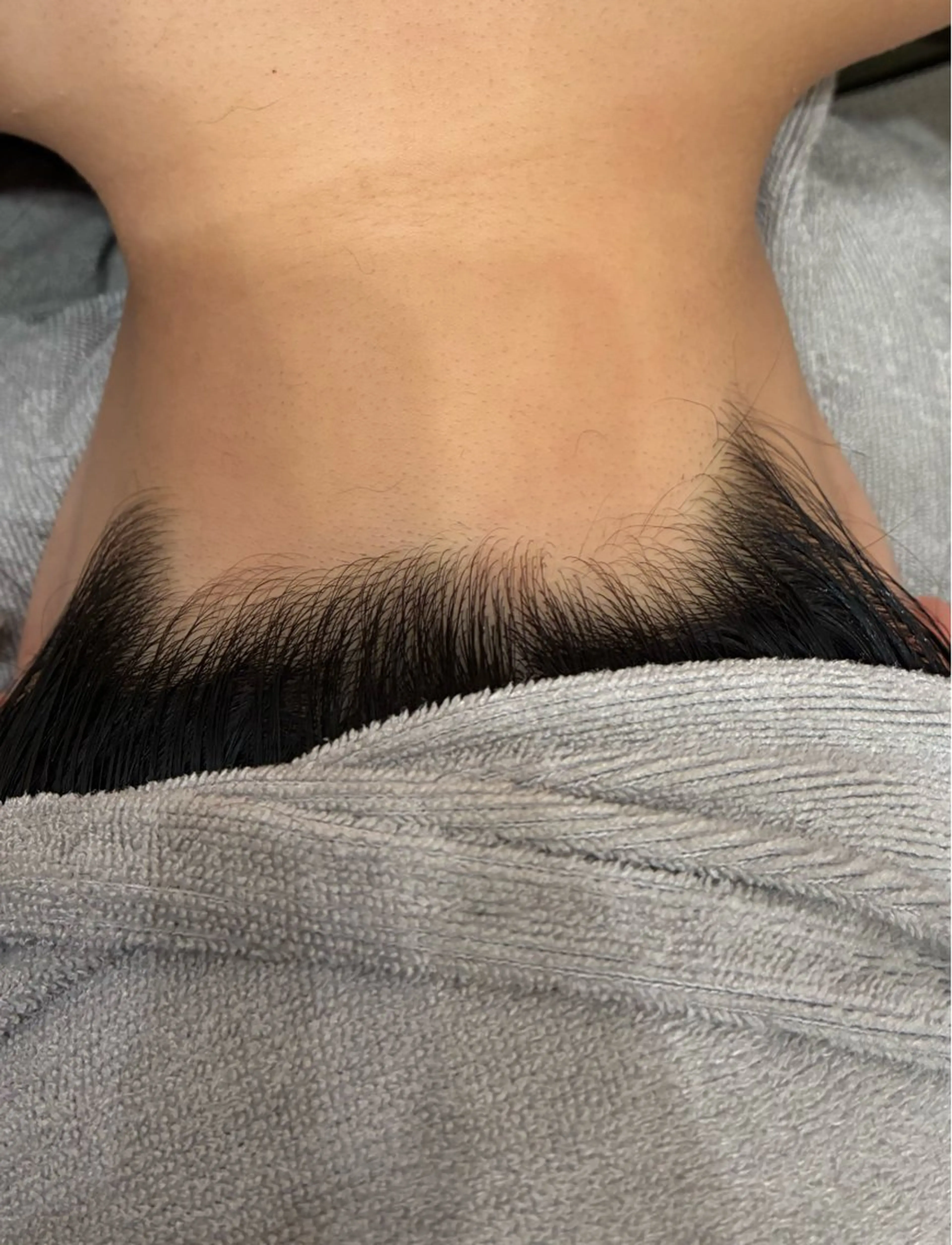 うなじ脱毛🌟の写真