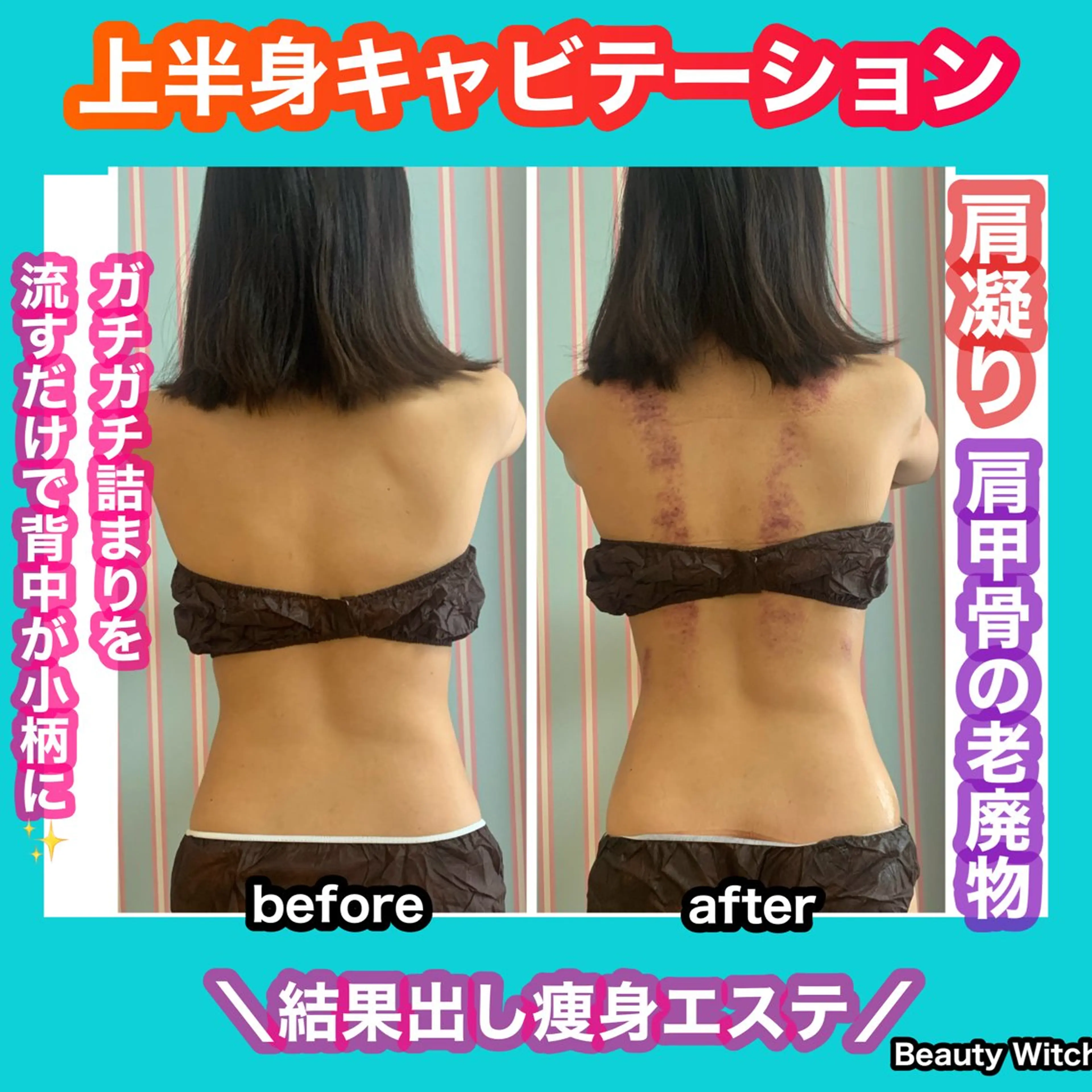 エステ リラク 痩身/脱毛/ネイル HARUKAのエステ・リラクイメージ