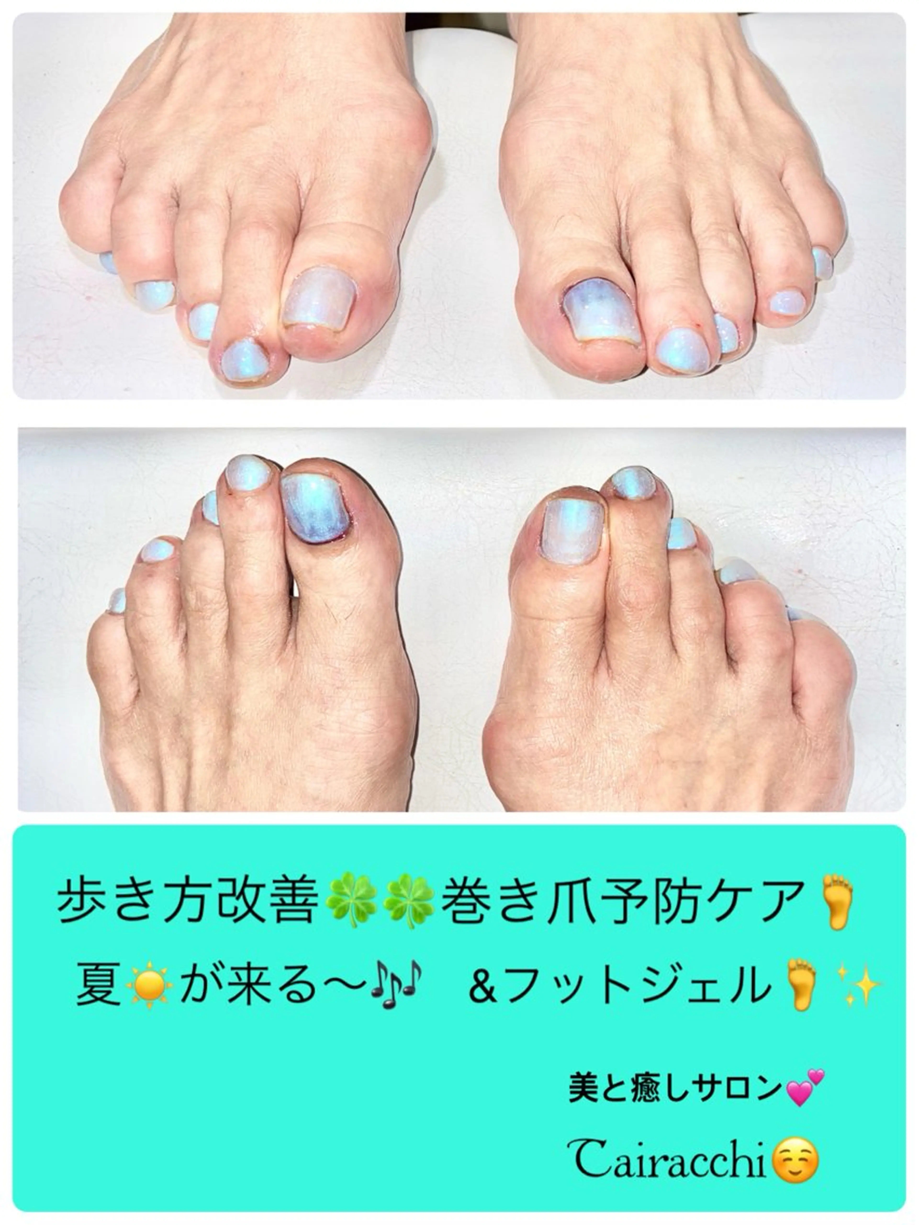 ネイル オーロラネイル ブルー フットネイル ホワイト フットネイル Tairacchi ﾀｲﾗｯﾁのエステ・リラクイメージ