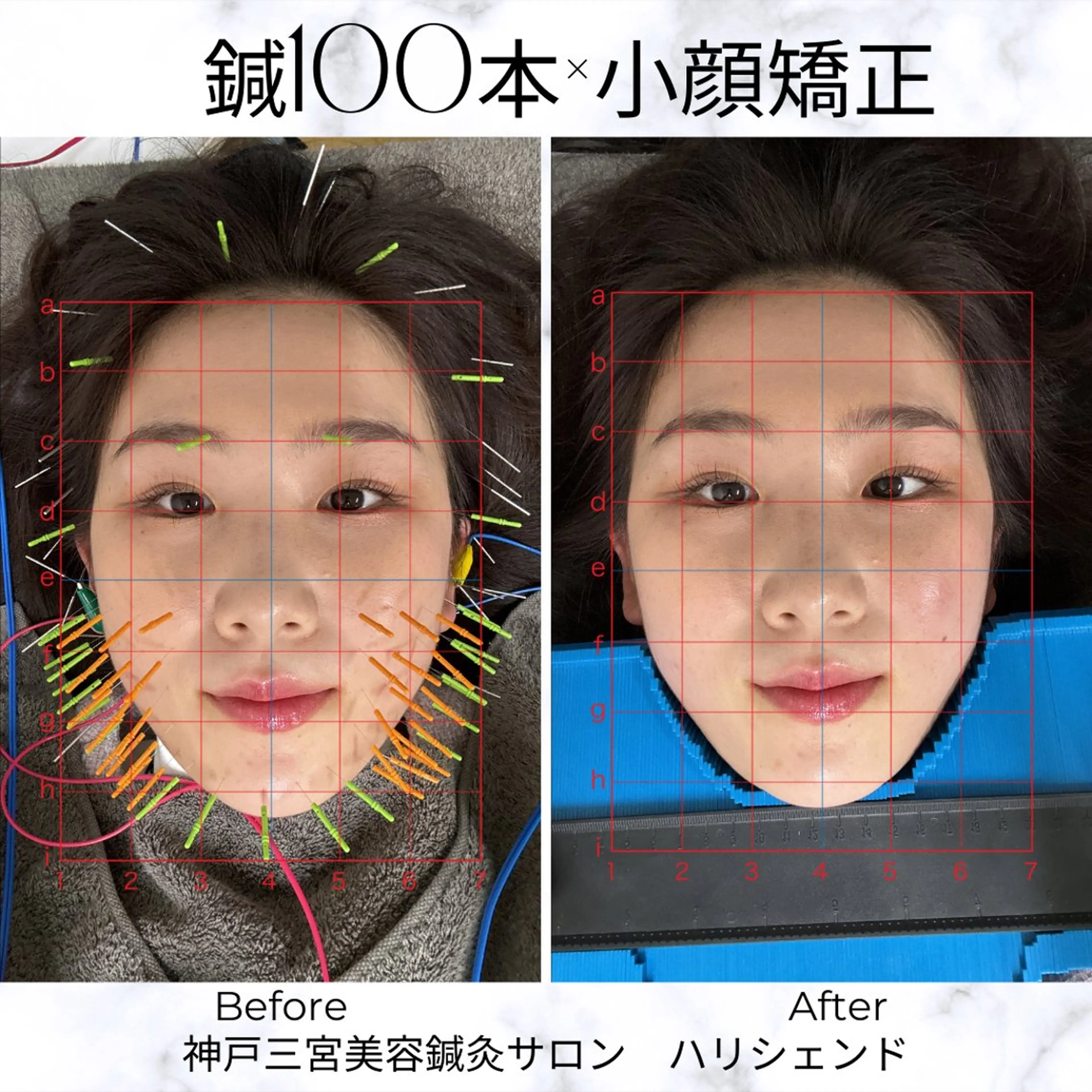 美容鍼・小顔矯正 ハリシェンドのエステ・リラクイメージ