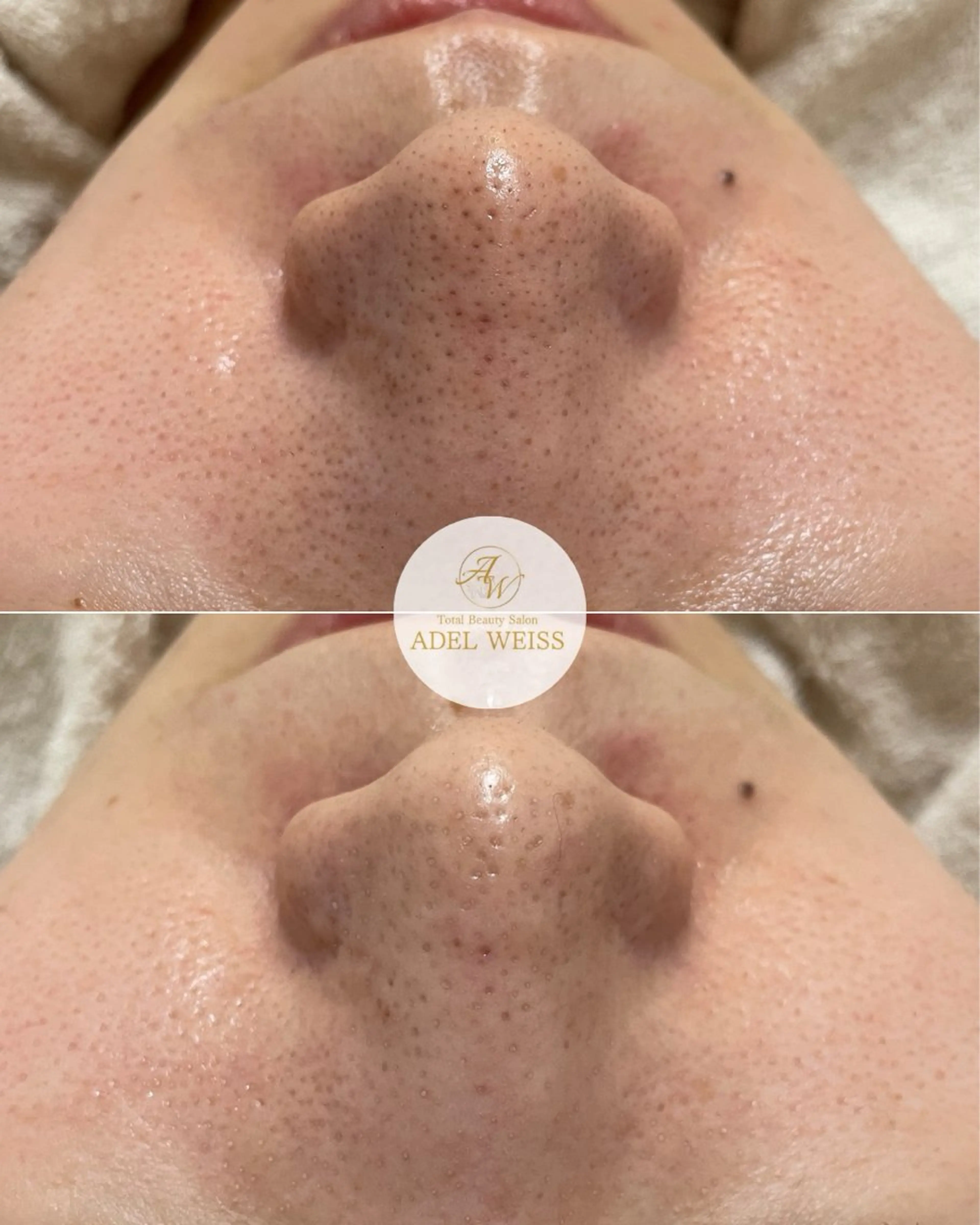 エステ リラク ADEL WEISS 脱毛＆毛穴＆リンパのその他イメージ
