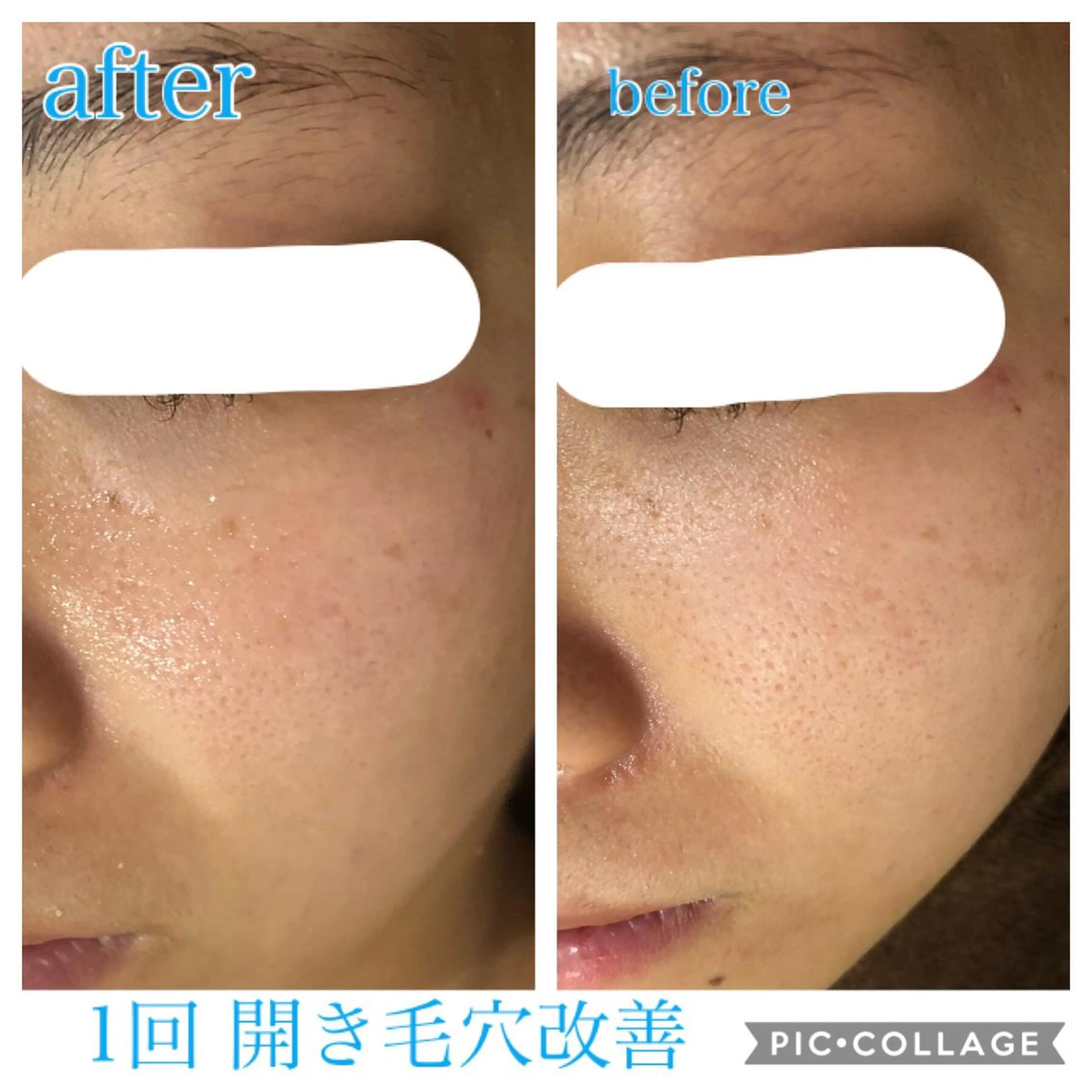 ロング カラー パーマ ヘアアレンジ キッズ ネイル マツエク・マツパ エステ リラク EnsorClair 代表 野口真央のエステ・リラクイメージ