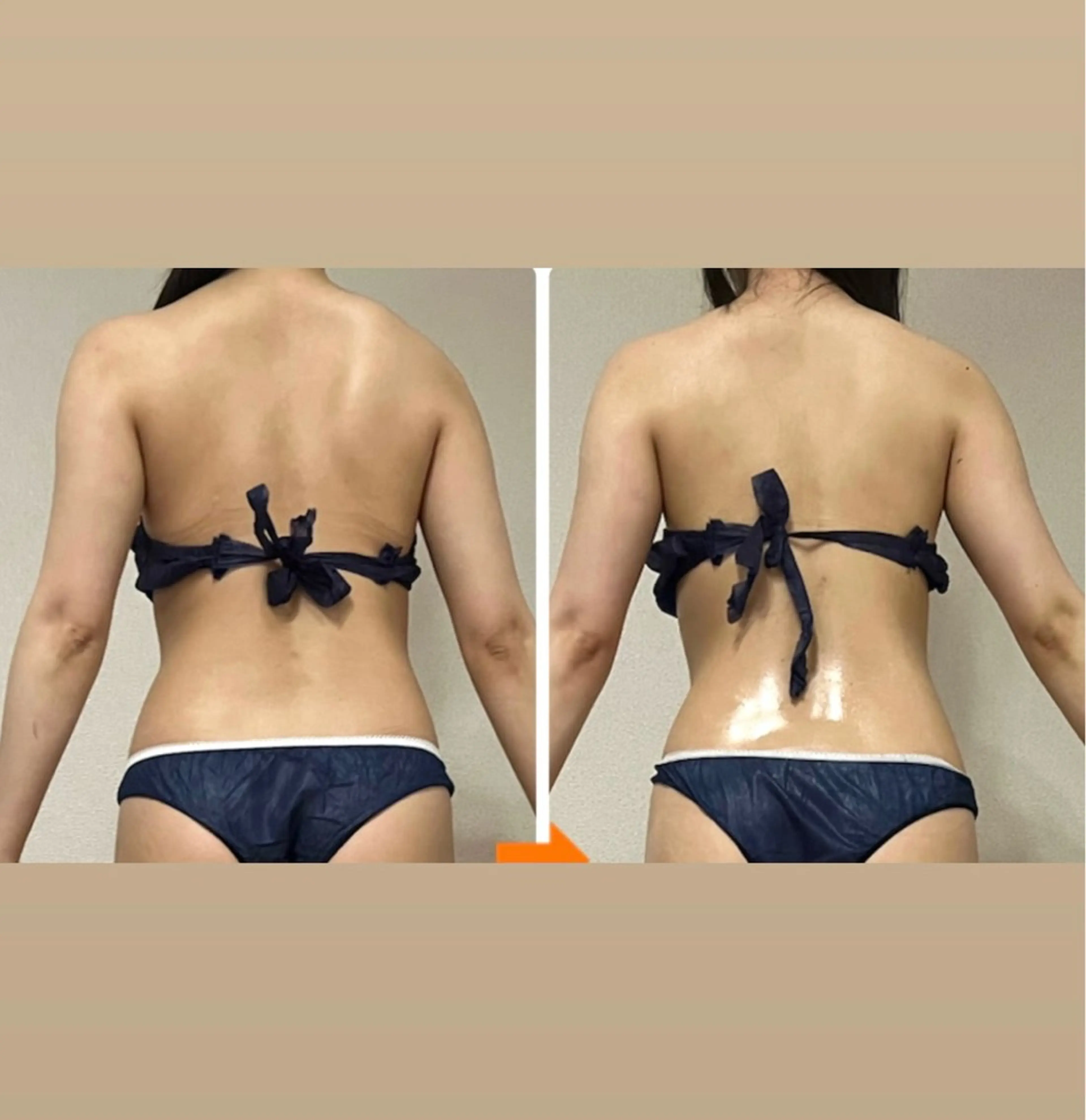 エステ リラク ‍痩身＆ボディ 結果出し🌟丹野のエステ・リラクイメージ