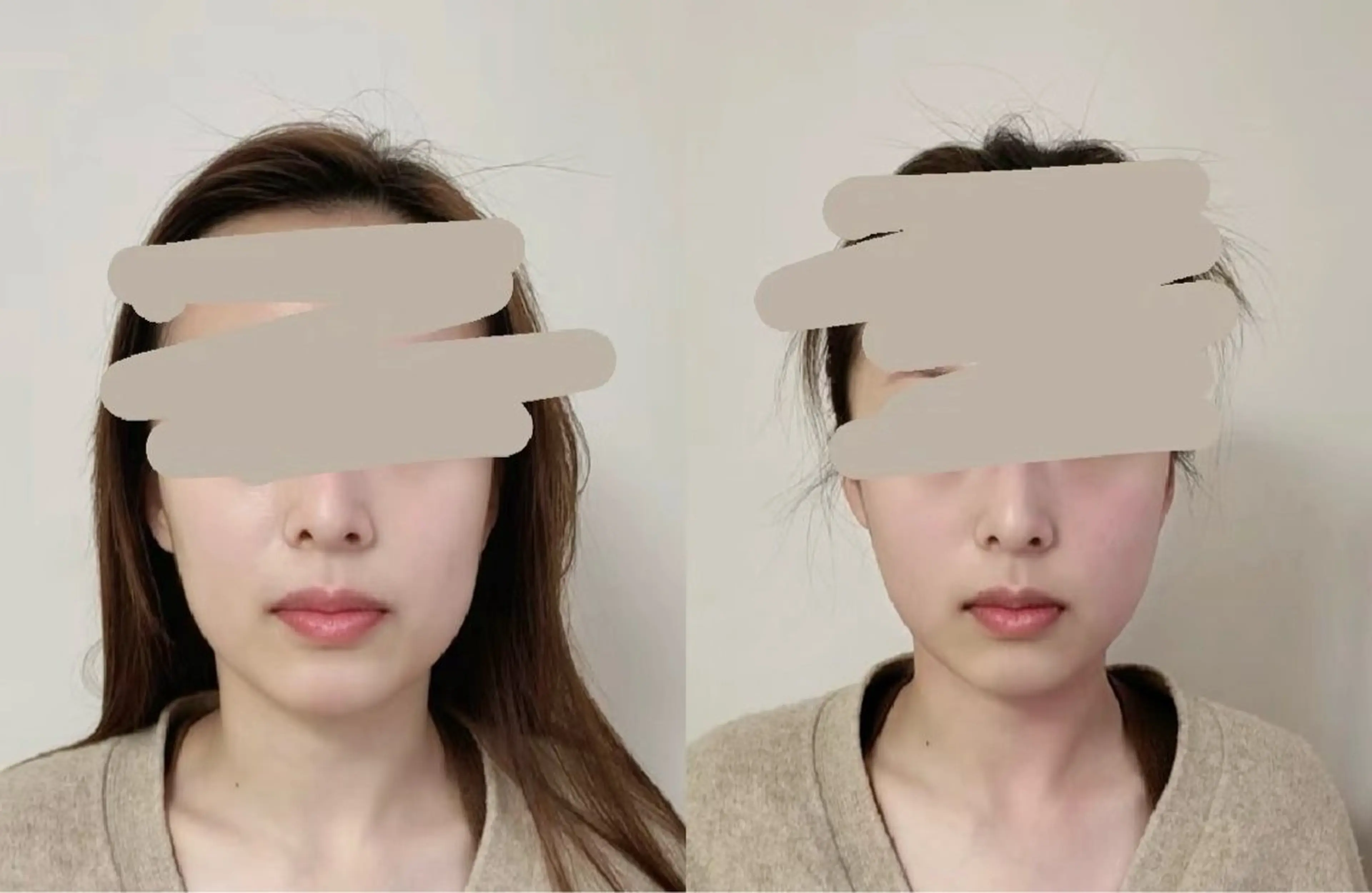 マツエク・マツパ エステ aliaハイフ&水光ジェットサロン所属・aliaハーブ水光店 エステティシャン募集のエステ・リラクイメージ