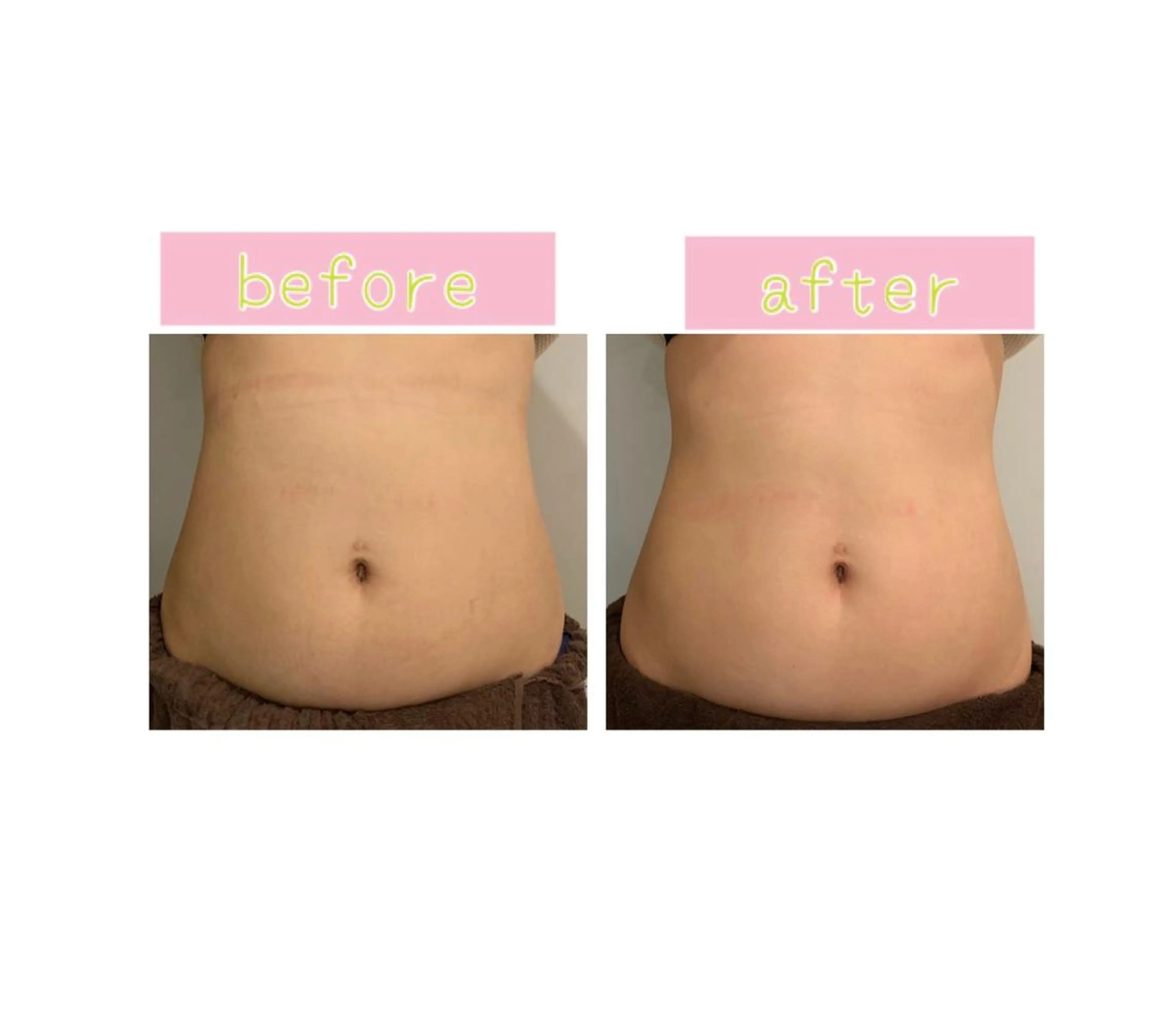 エステ 癒し腸もみサロン シャユーム　ゆきなのエステ・リラクイメージ