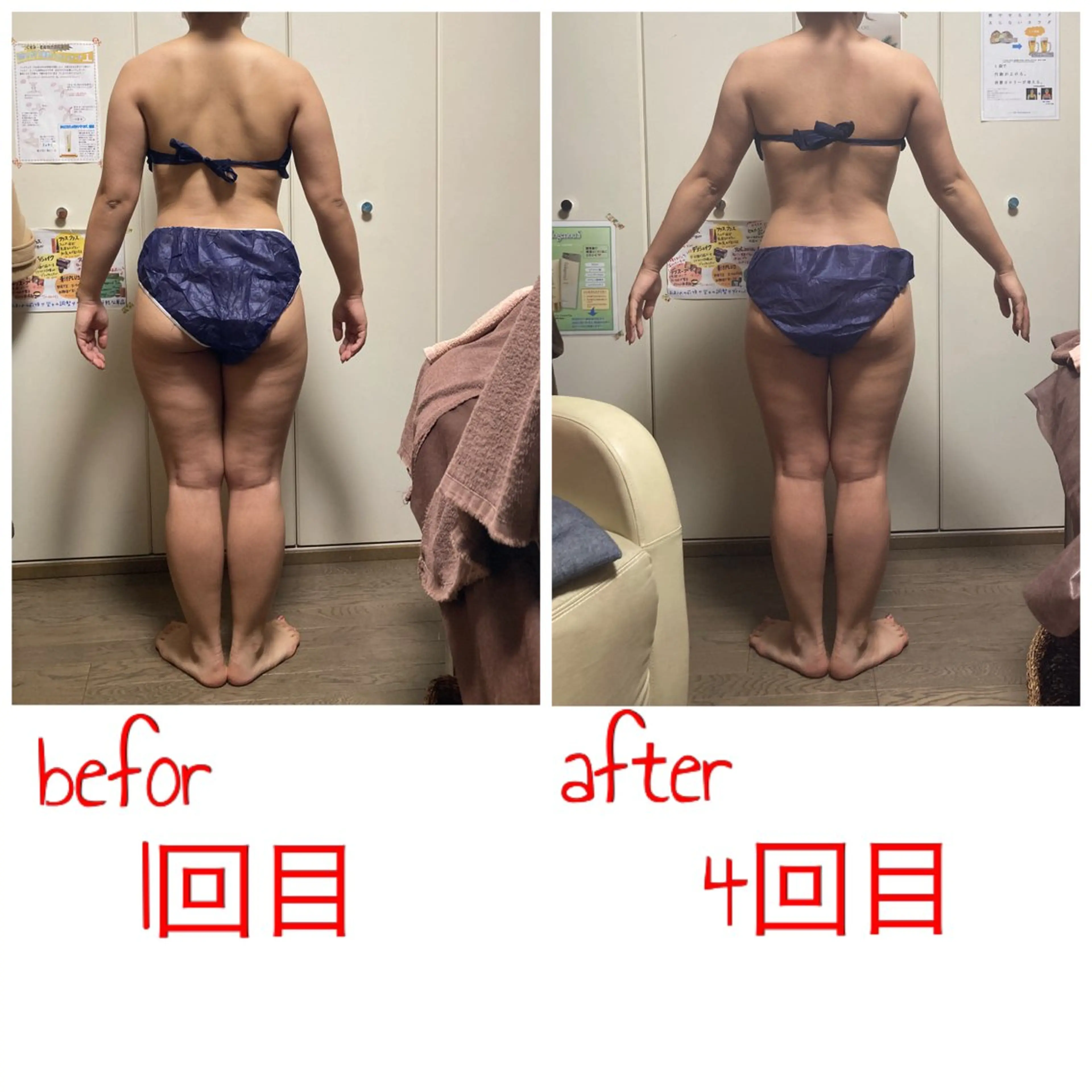 強圧デトックスリンパ 育菌専門店のその他イメージ