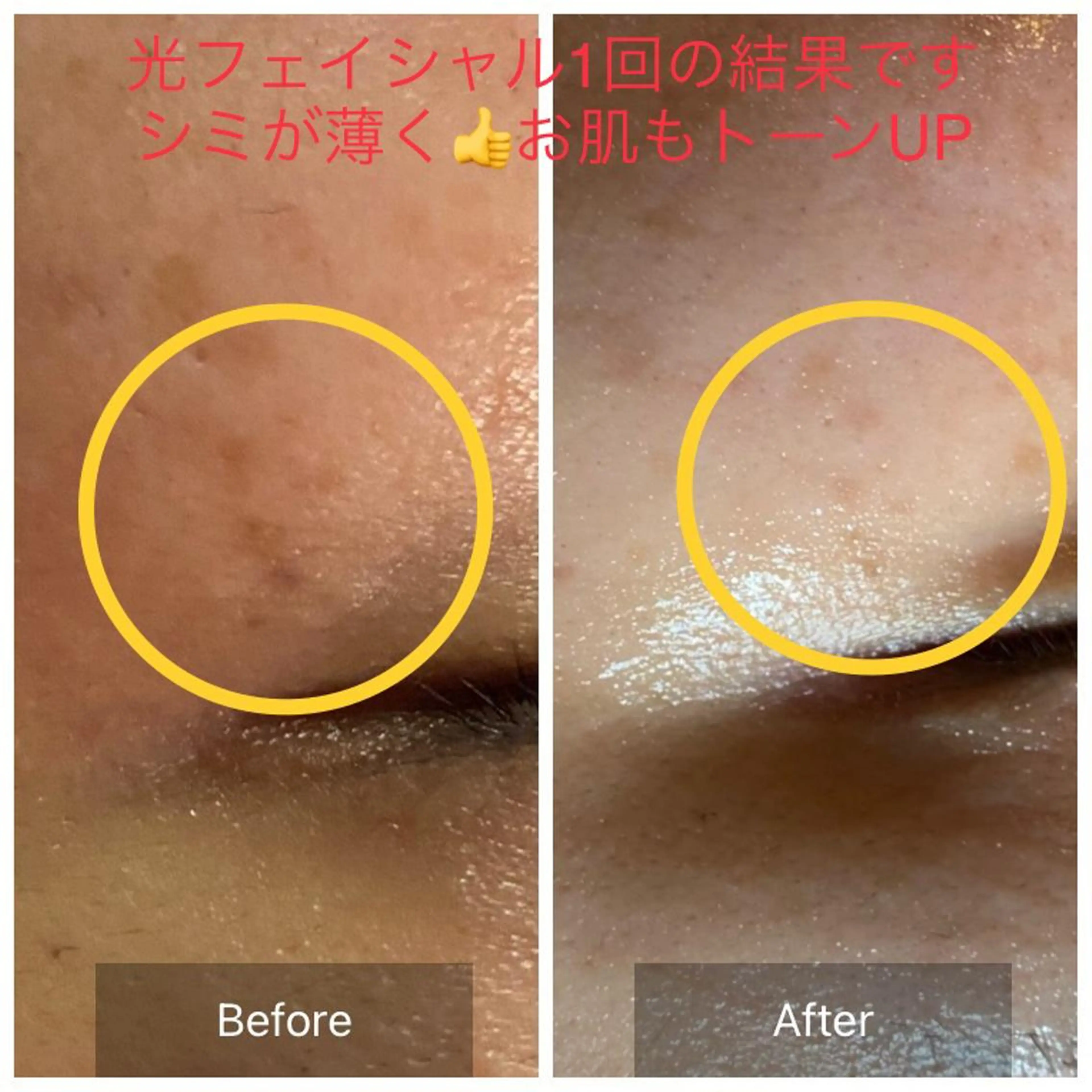 Mandarin Orange所属・毛穴から始める肌メン テマンダリンオレンジのエステ・リラクイメージ