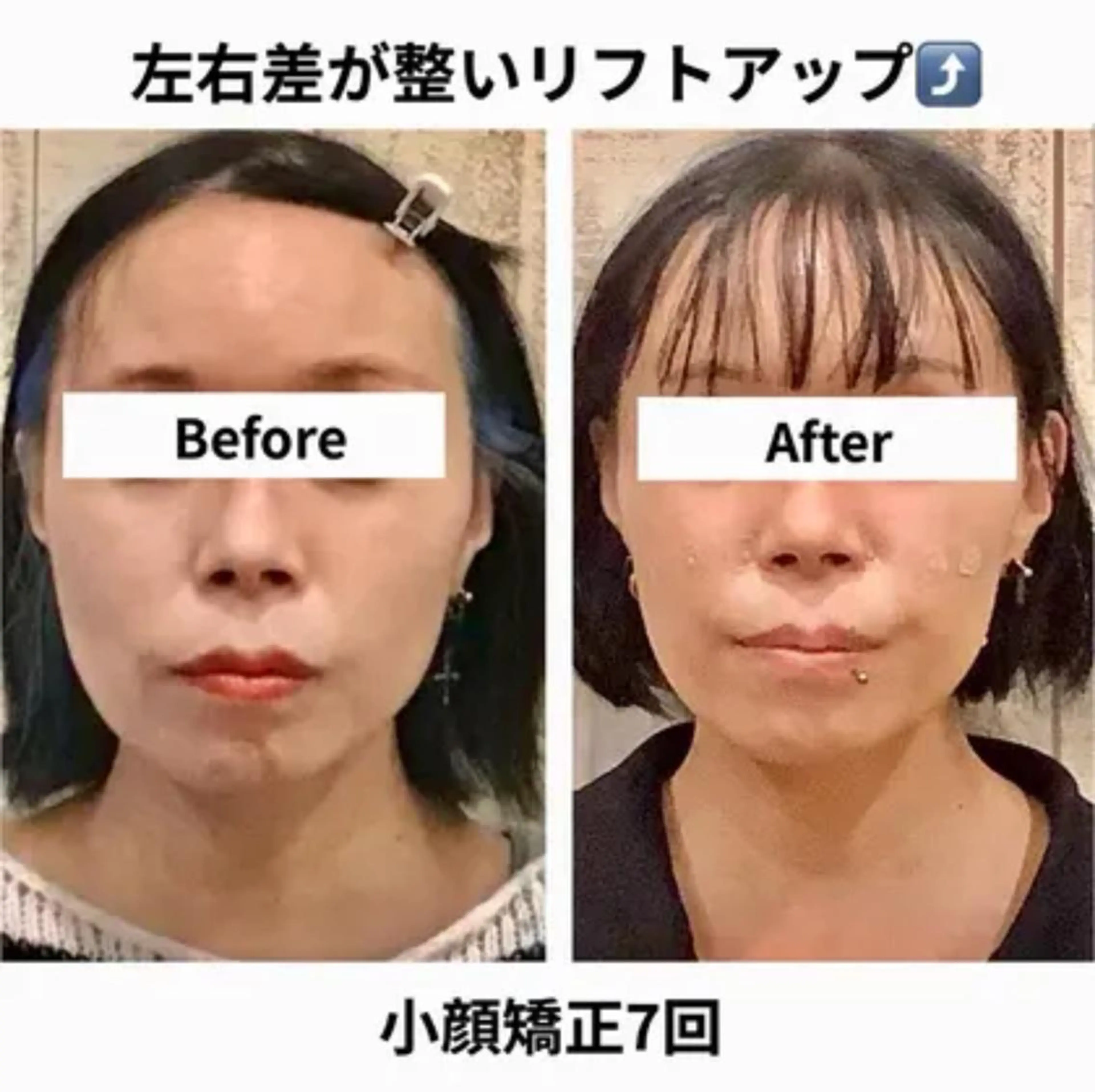 小顔矯正 natsuのエステ・リラクイメージ