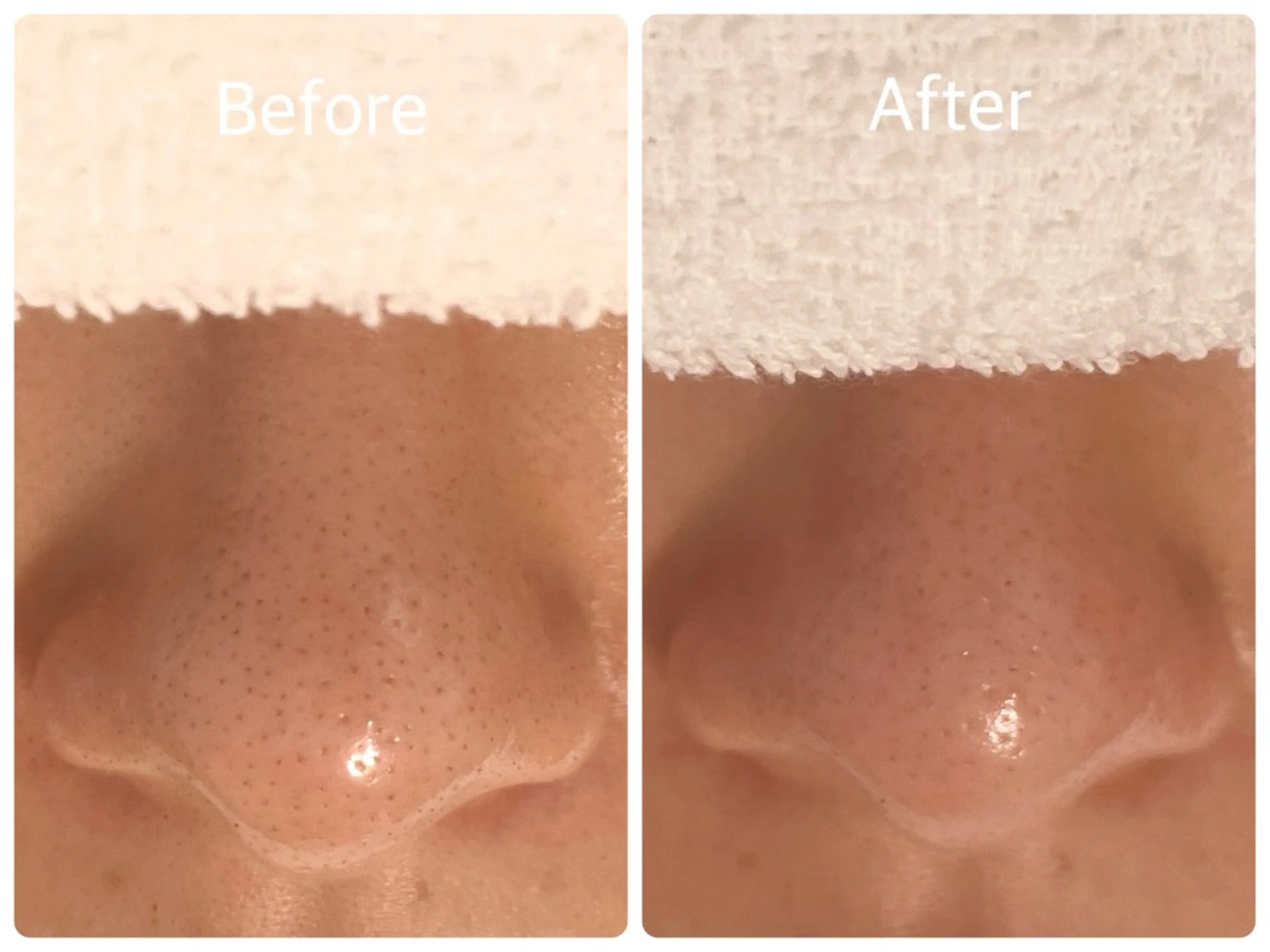 salon HATOのエステ・リラクイメージ