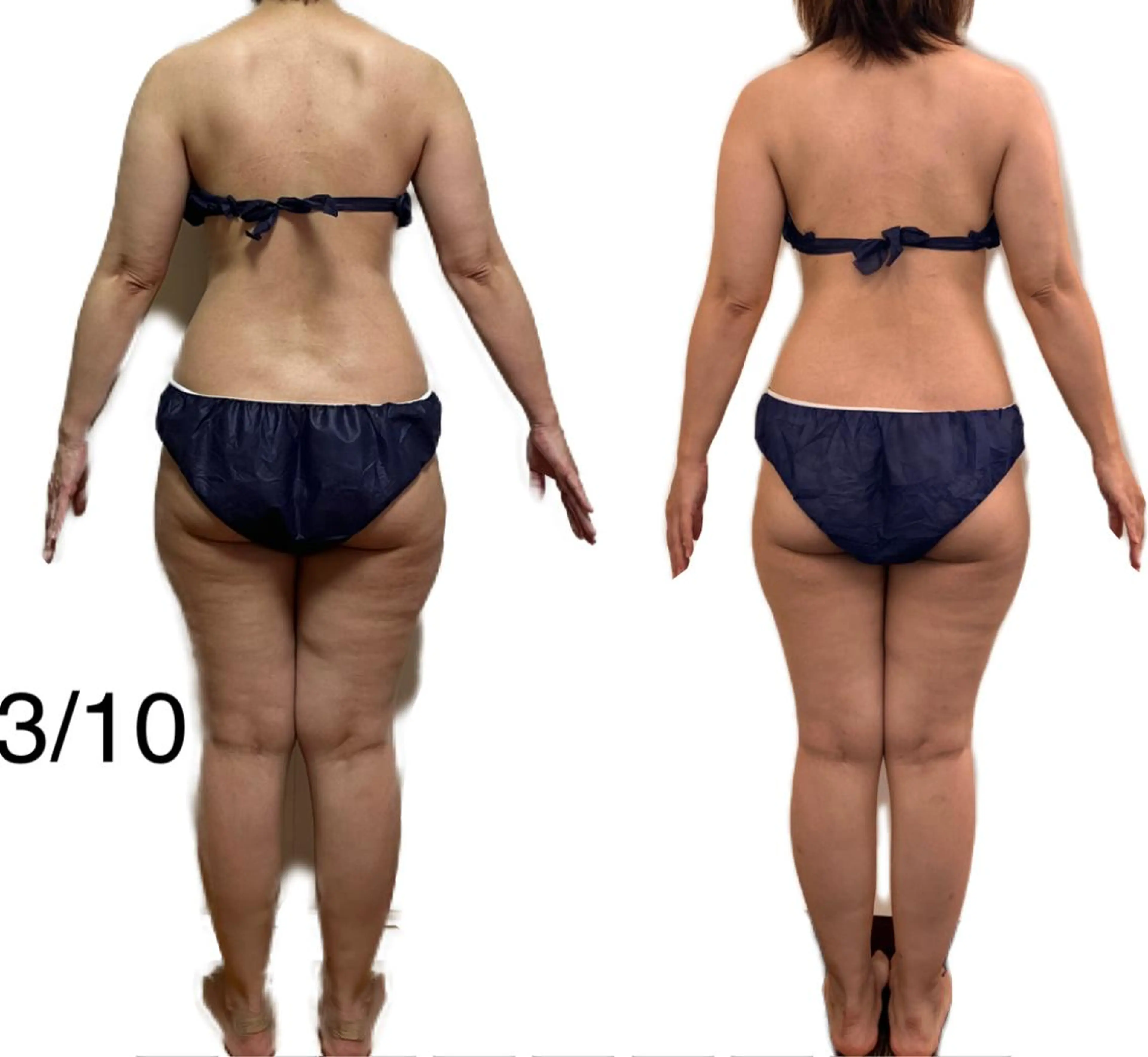 エステ ひやね まゆみのエステ・リラクイメージ