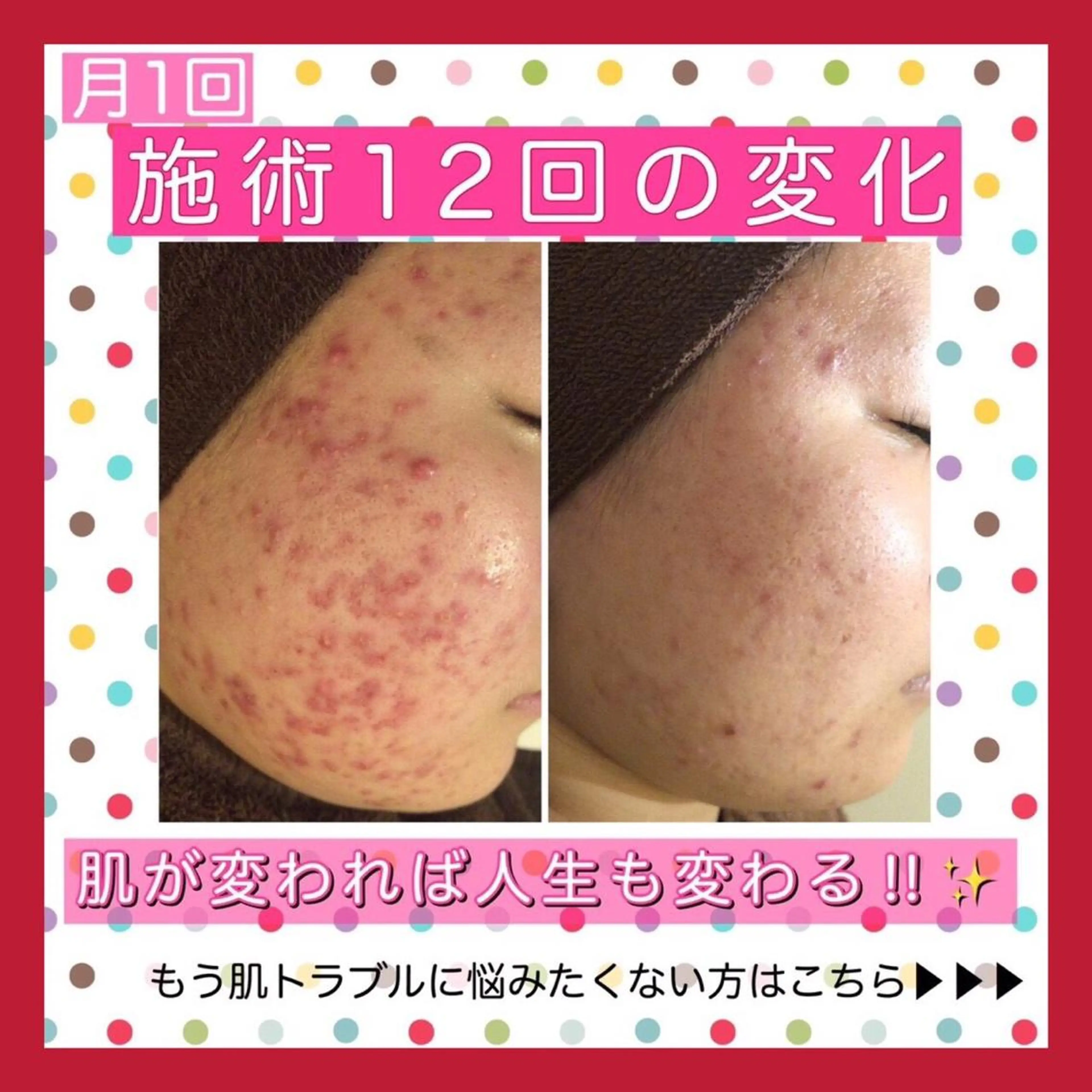 ミディアム パーマ ヘアアレンジ メンズ キッズ ネイル マツエク・マツパ ニキビ・肌質改善専門 ♡人生が変わるサロンのエステ・リラクイメージ