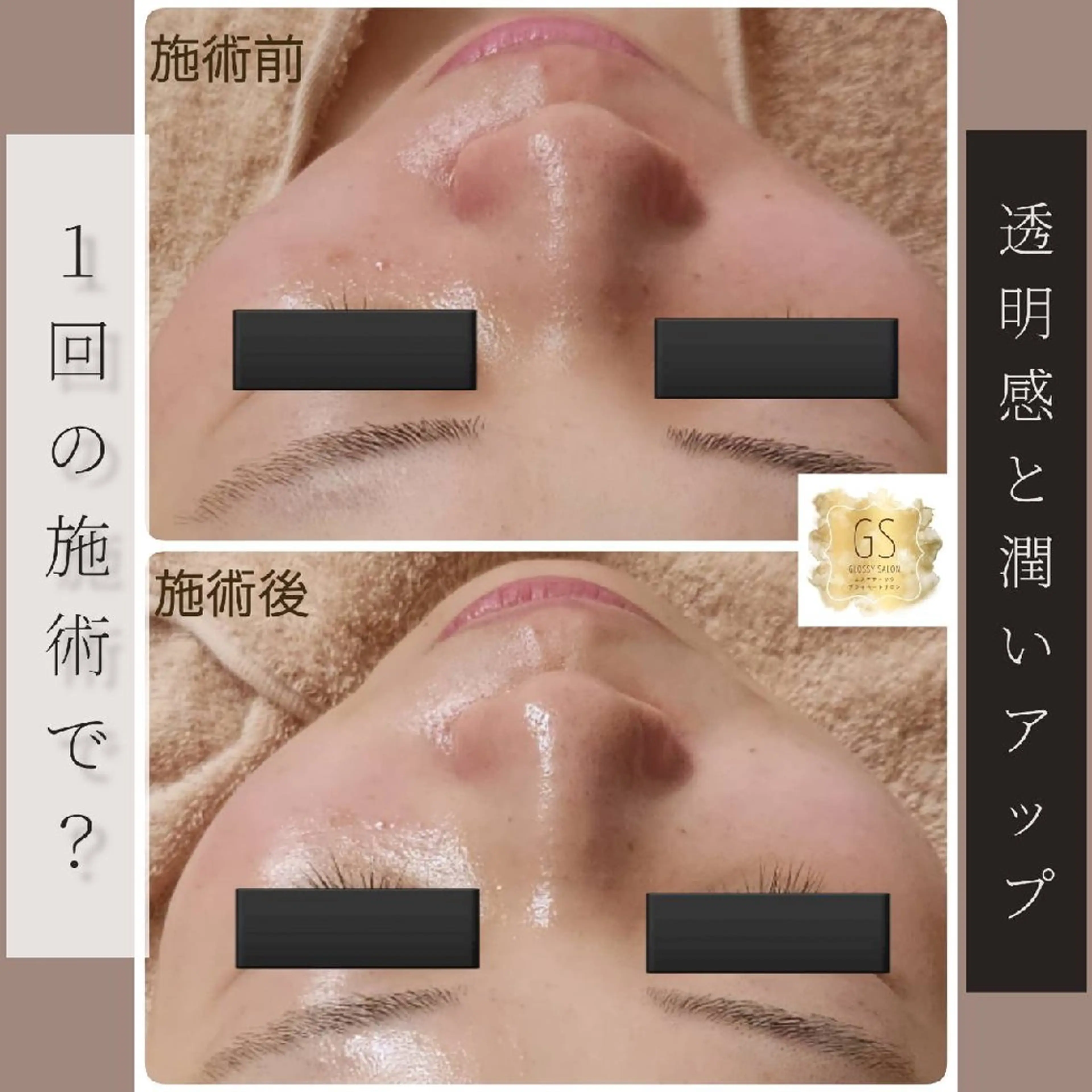 エステ リラク Glossy salonのエステ・リラクイメージ