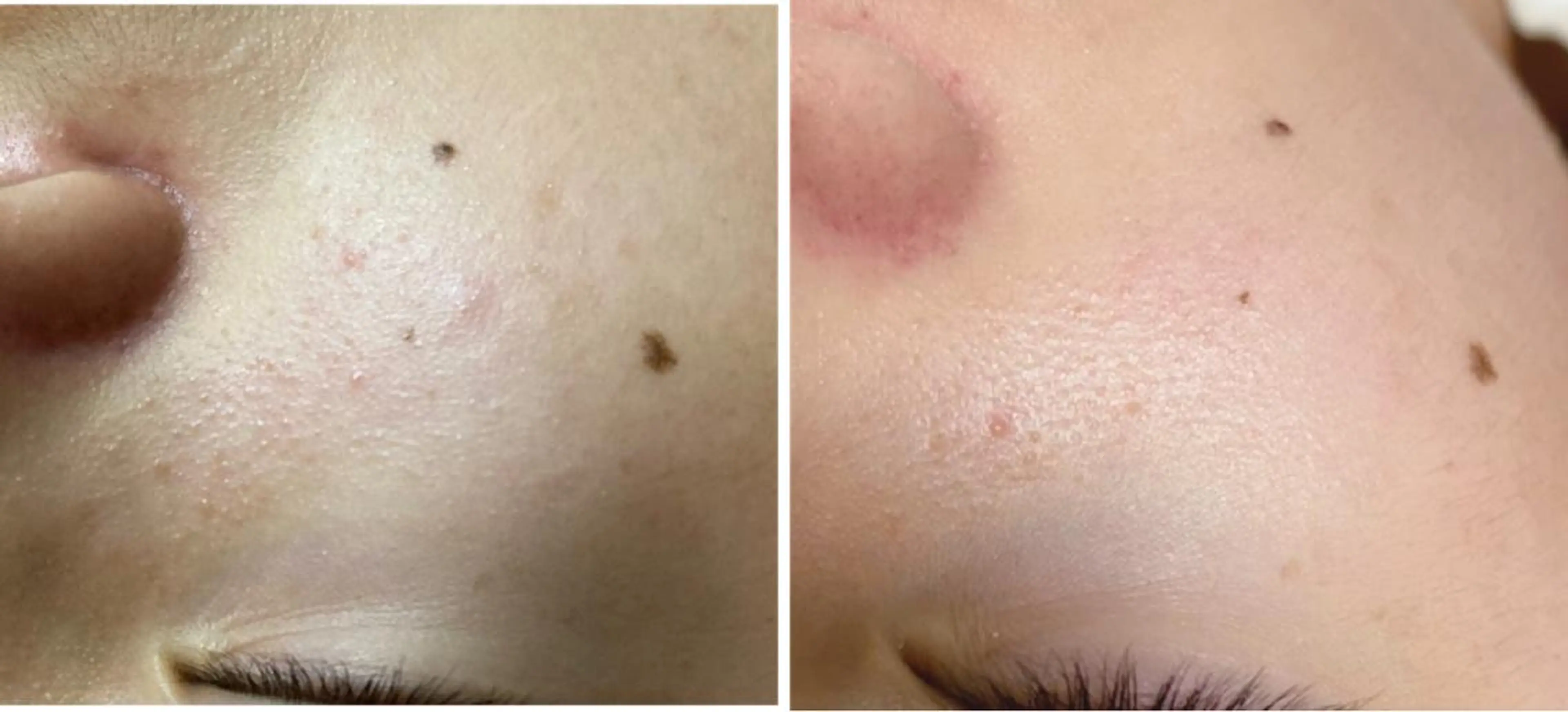 エステ ピーリング専門サロン Spicaのエステ・リラクイメージ