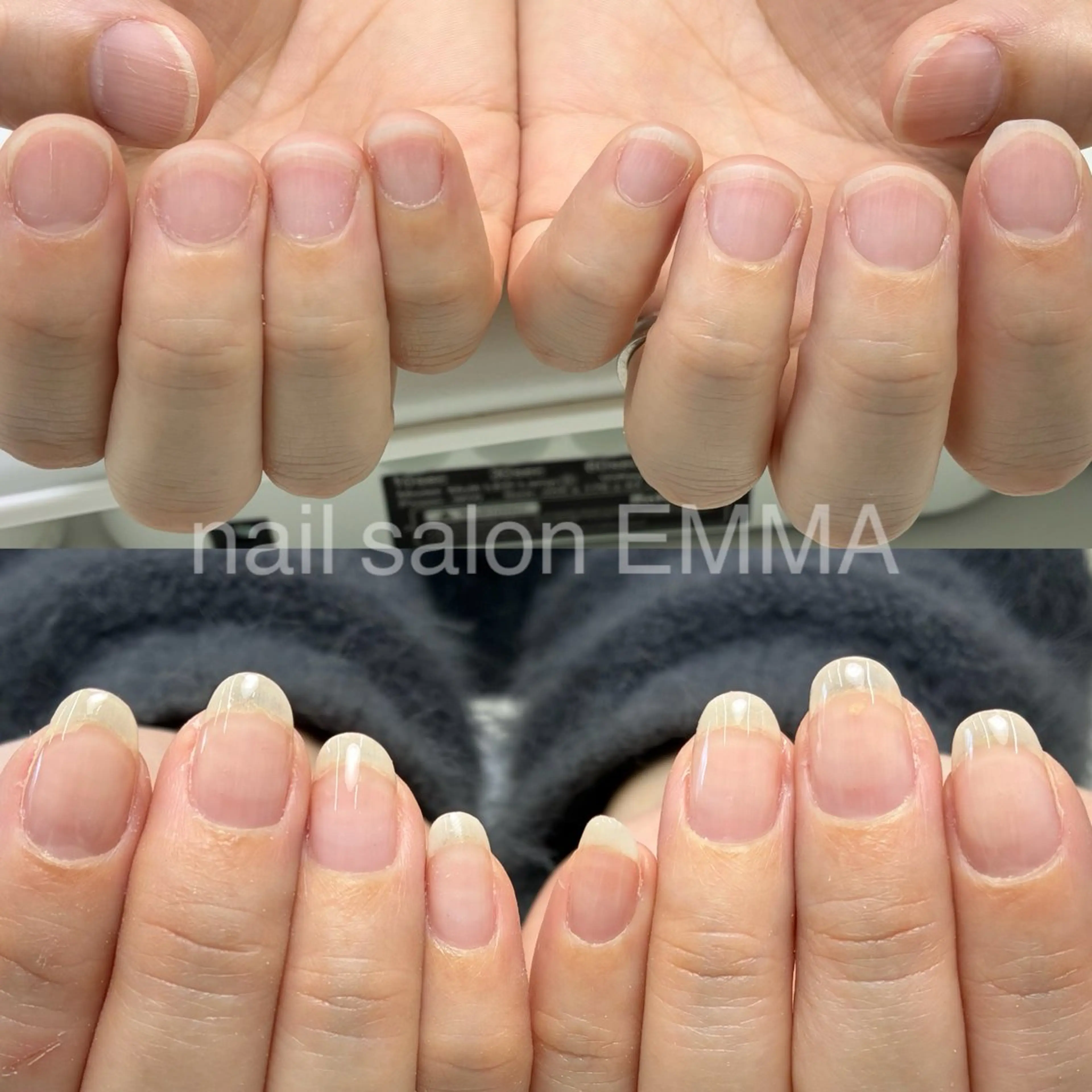 ネイル 広島市南区(広島県) /深爪/自爪育成のネイルデザイン