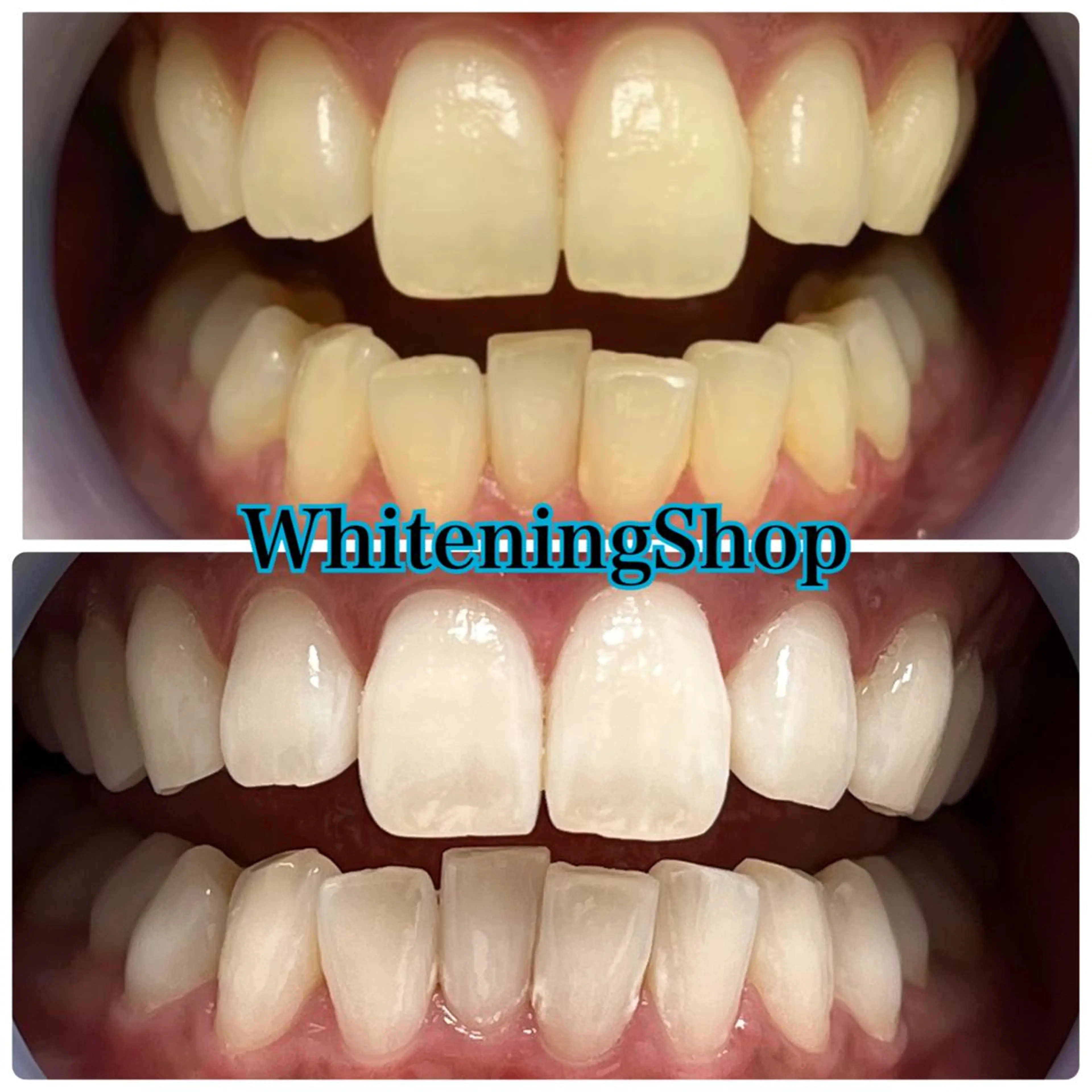 ホワイトニング ショップ吉祥寺店のエステ・リラクイメージ