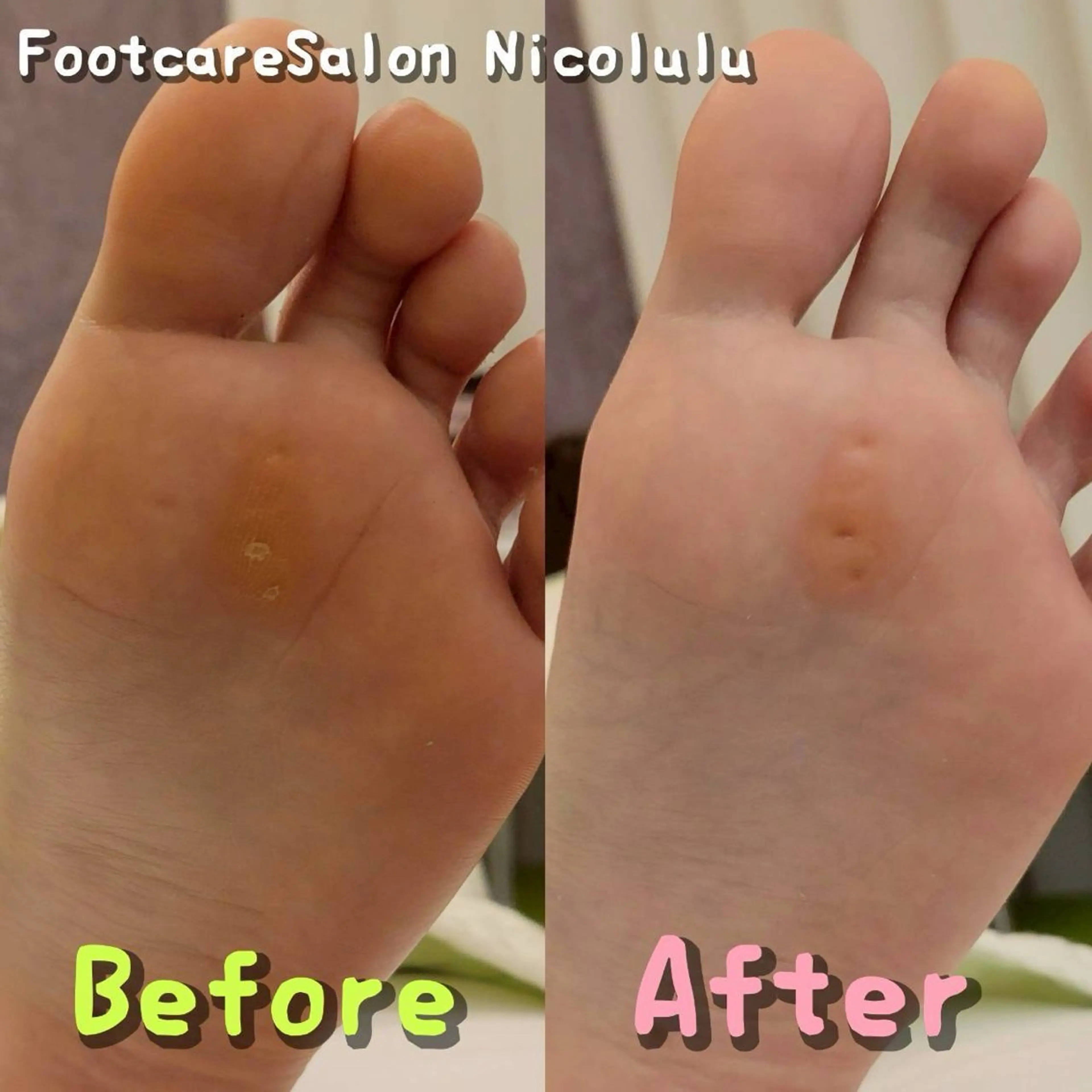 リラク 足トラブル専門 ニコルル金沢のエステ・リラクイメージ