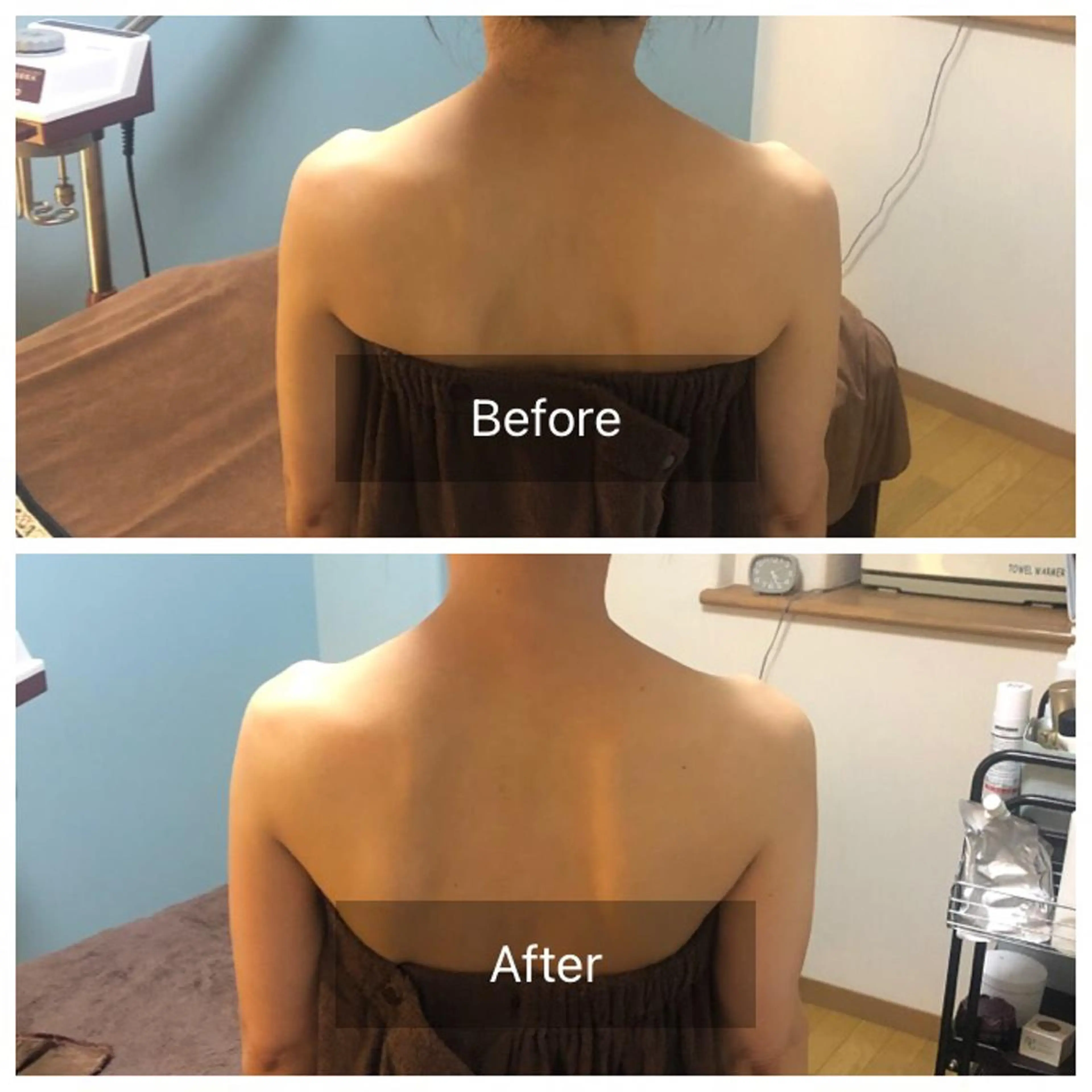 【初回限定🌿】リピート多数!/背中美人/肩甲骨ケア/大人ニキビ/肩首コリ/眼精疲労/敏感肌/リペルコース120minの写真