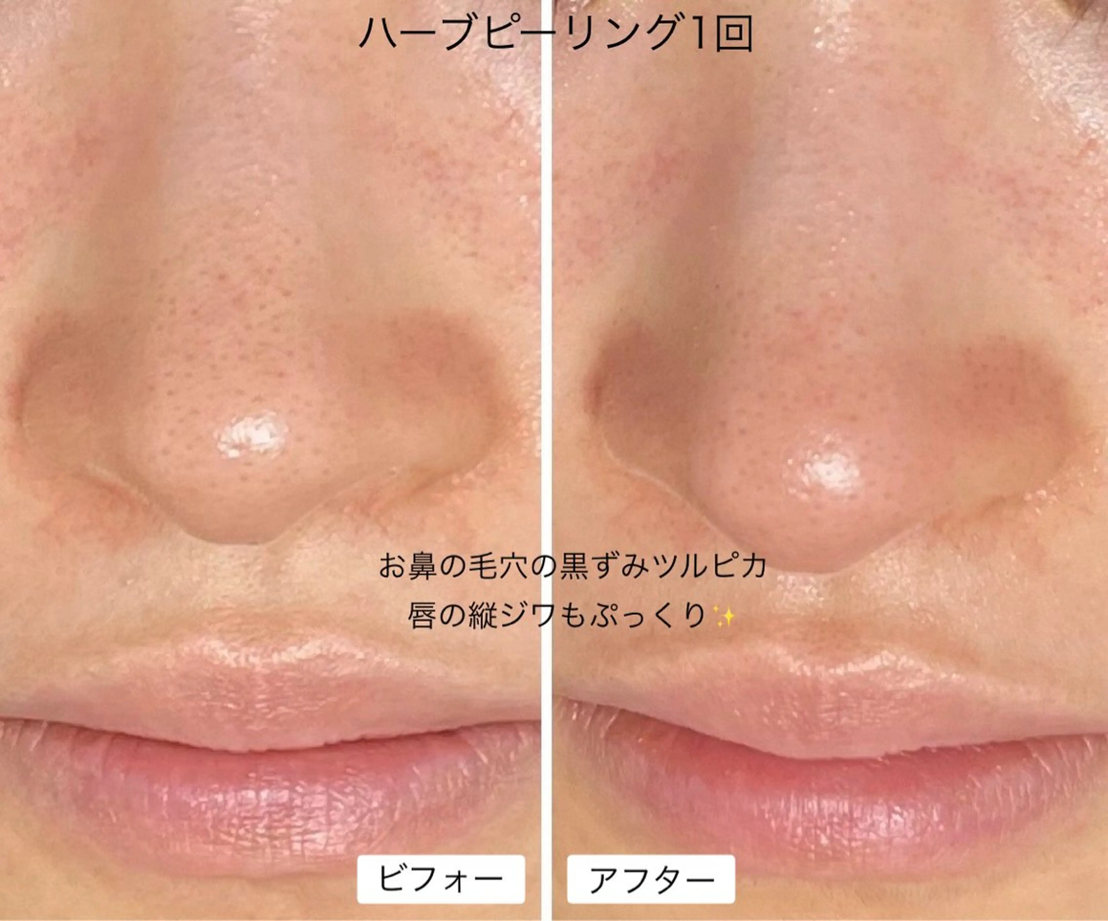 アーユルヴェーダ専門 スローガーデンのエステ・リラクイメージ