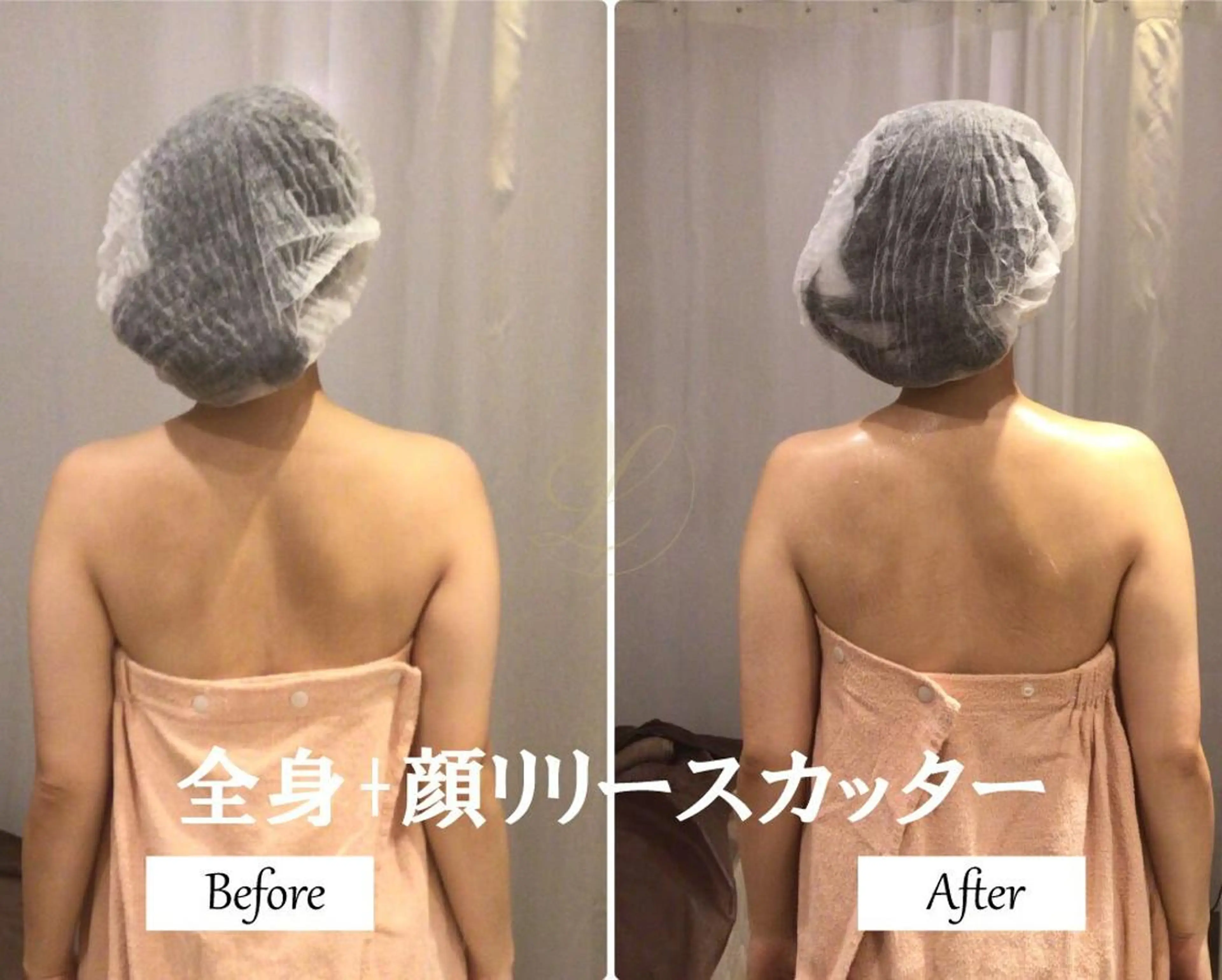 ブライダルサロン |Lino【堀江】のエステ・リラクイメージ