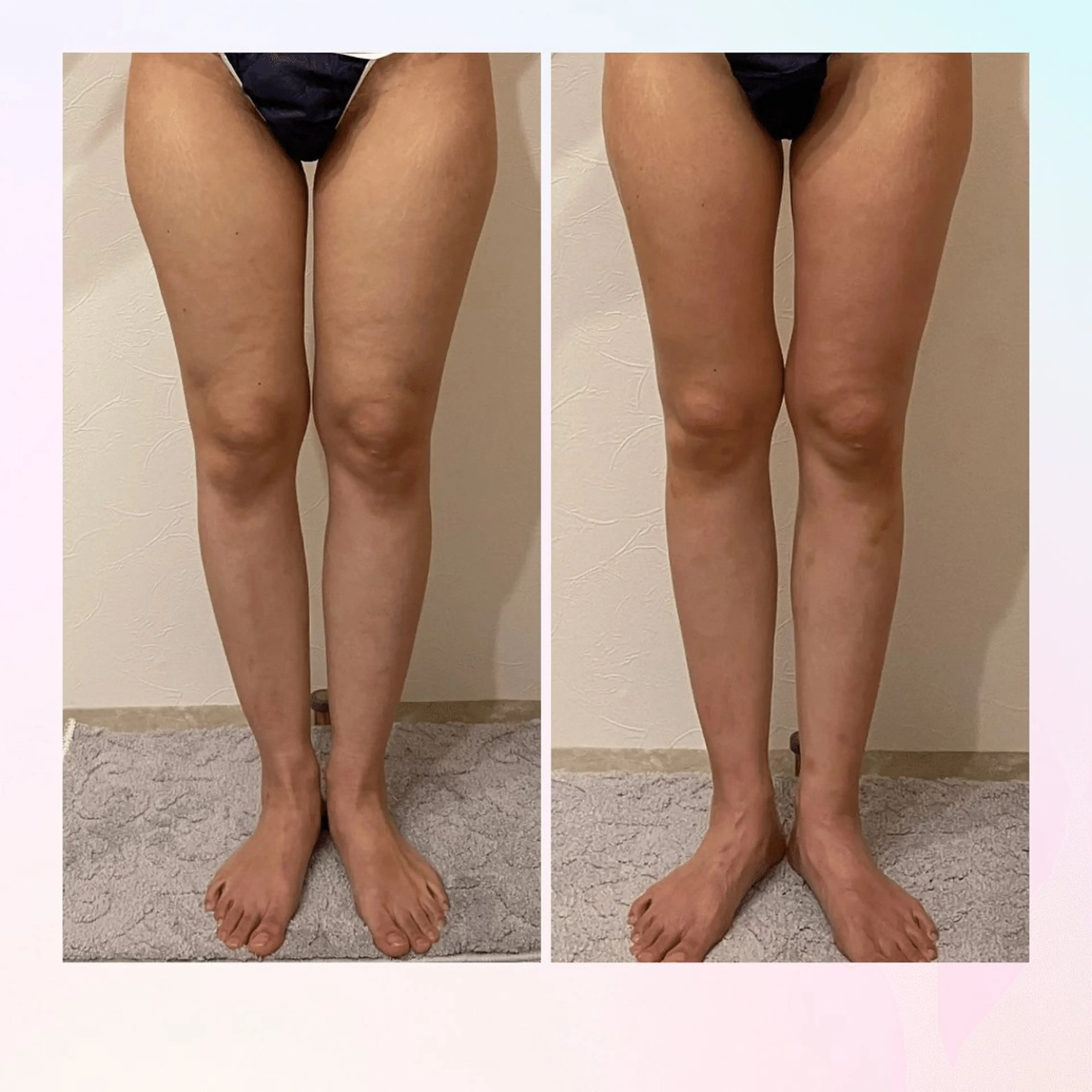 バストアップ・痩身 脱毛/🌺コオリナのエステ・リラクイメージ