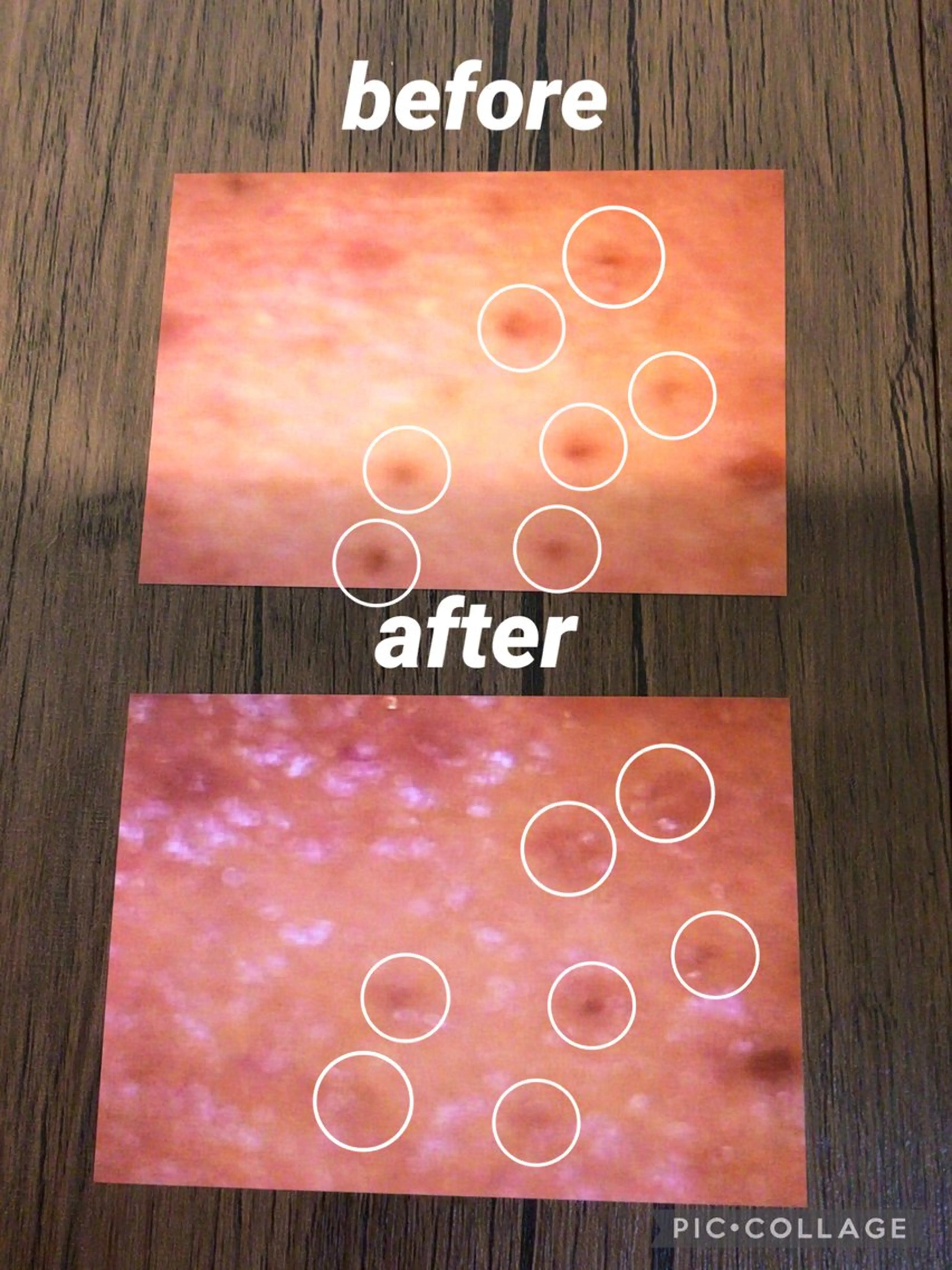 毛穴専門店 アフロディーテのエステ・リラクイメージ