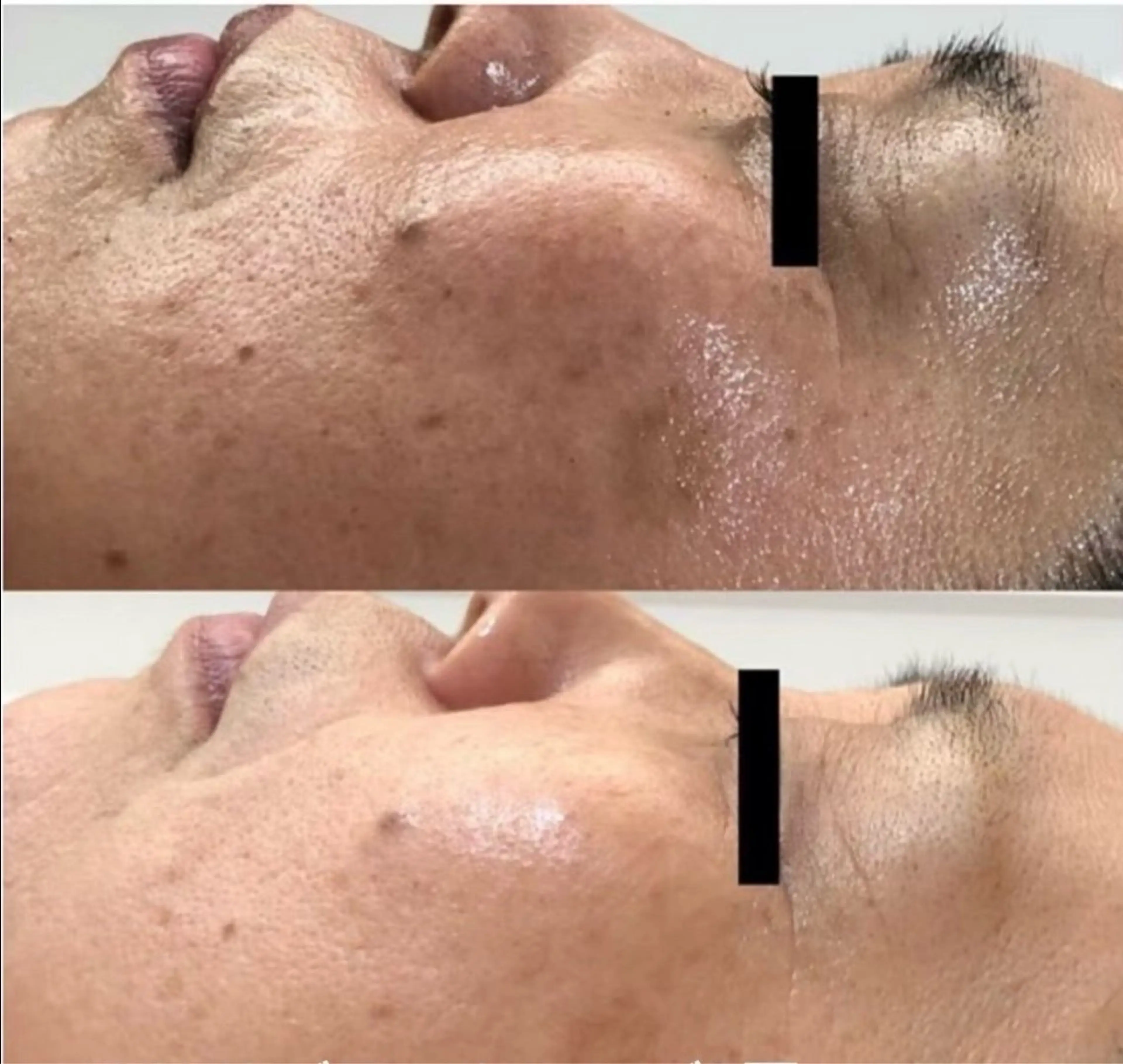 SUN MIWAのエステ・リラクイメージ