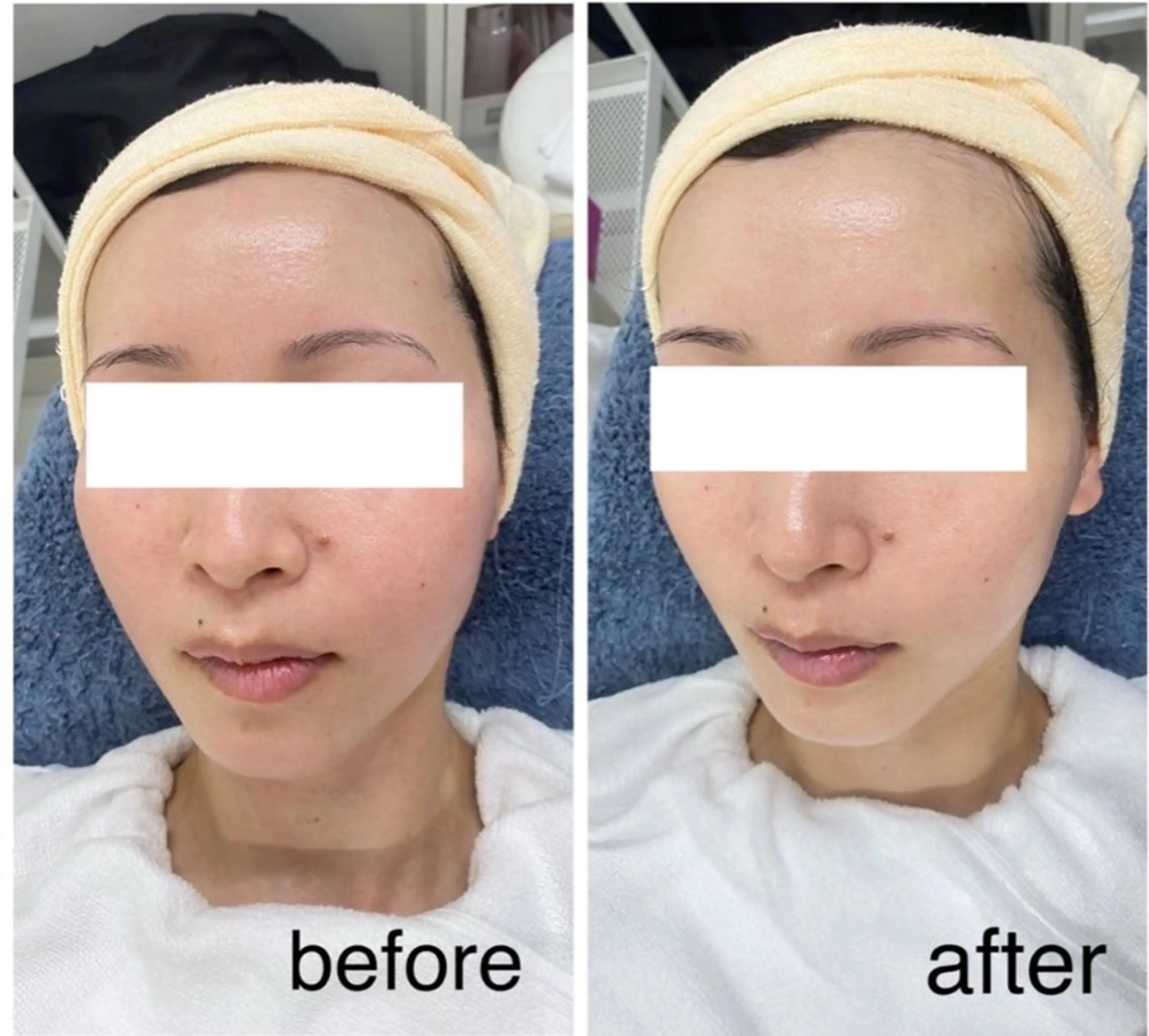 相模原/毛穴/ニキビ フェイシャルRikoのエステ・リラクイメージ