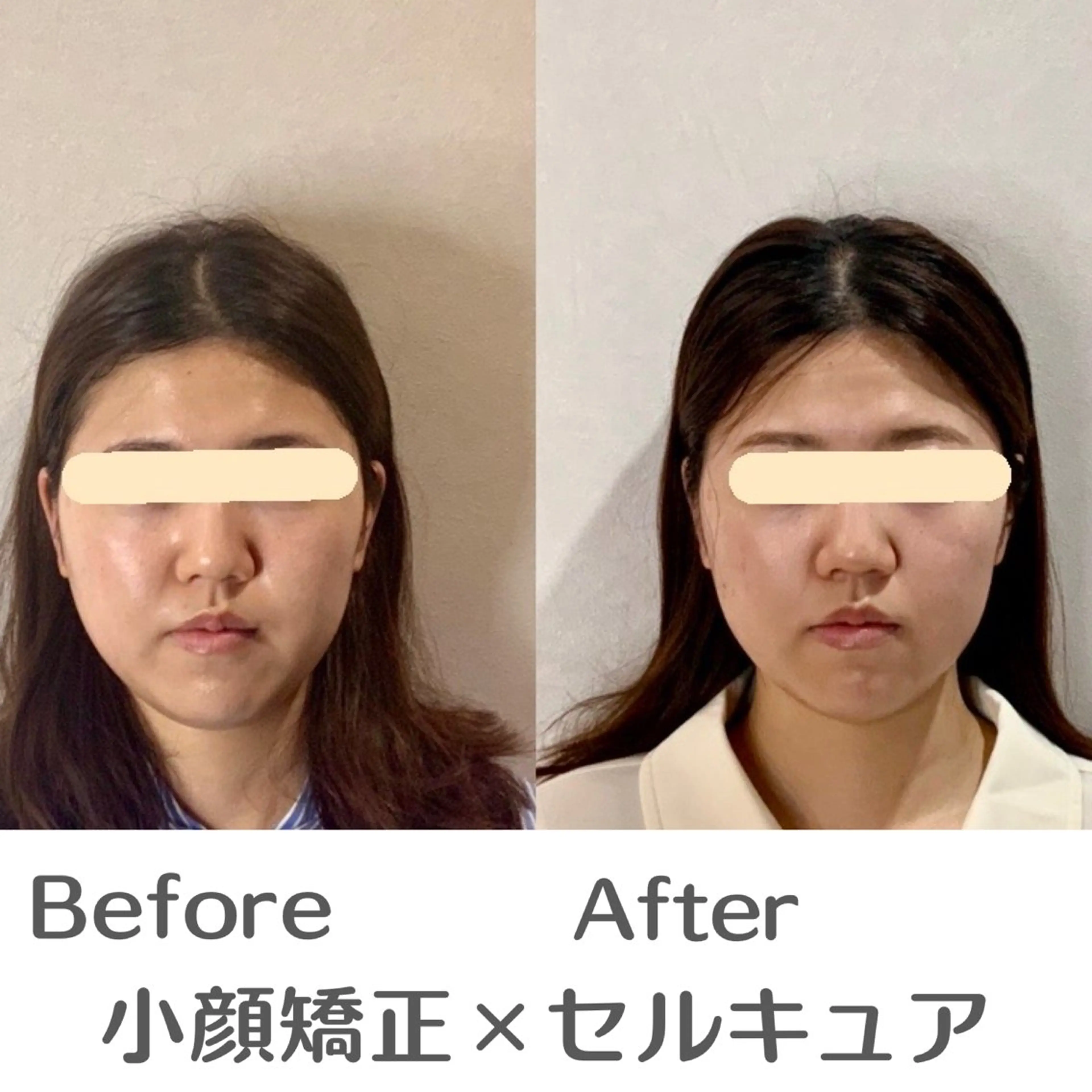 エステ 巻き肩・猫背矯正 小顔　espoirのエステ・リラクイメージ