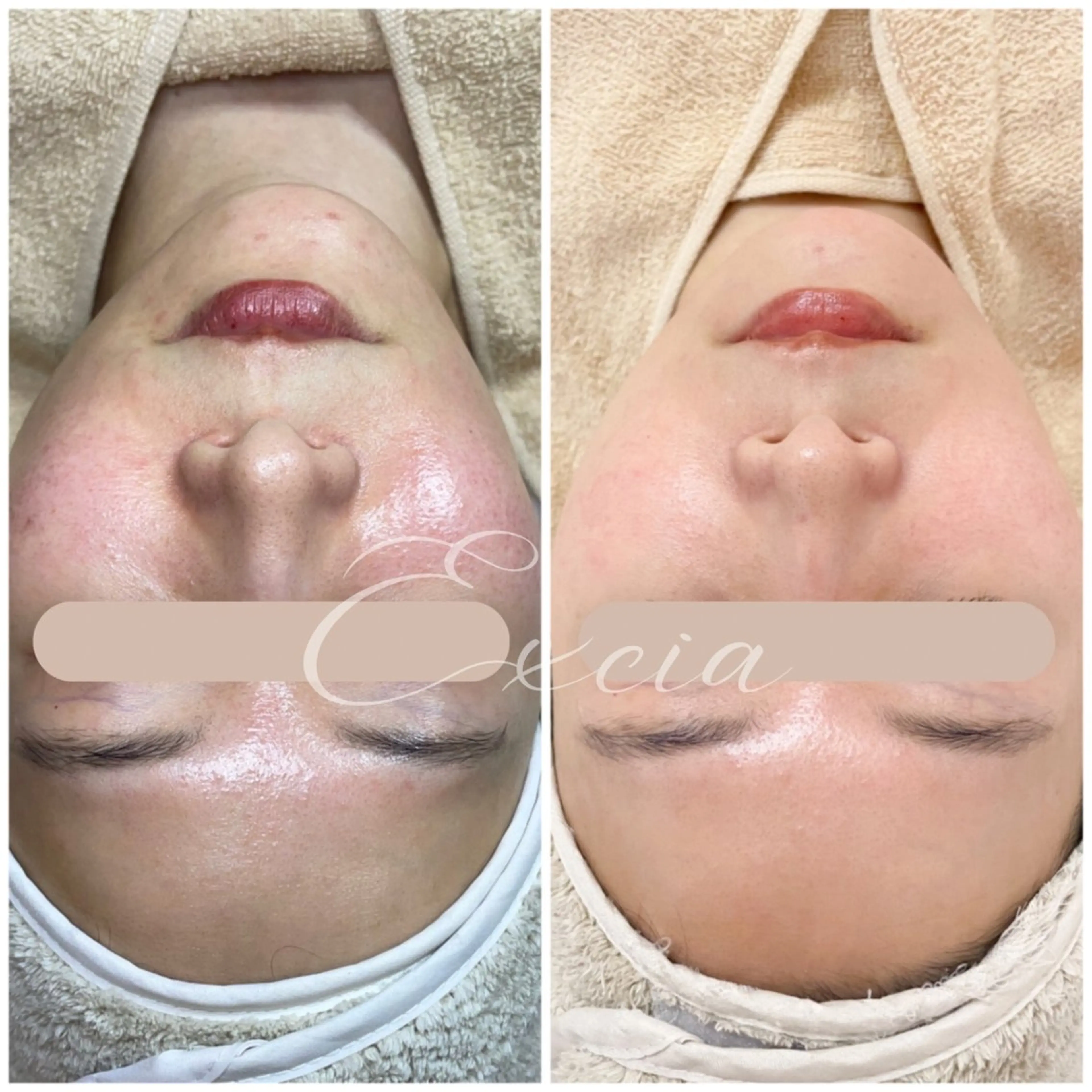 EXCIA （エクシア）のエステ・リラクイメージ