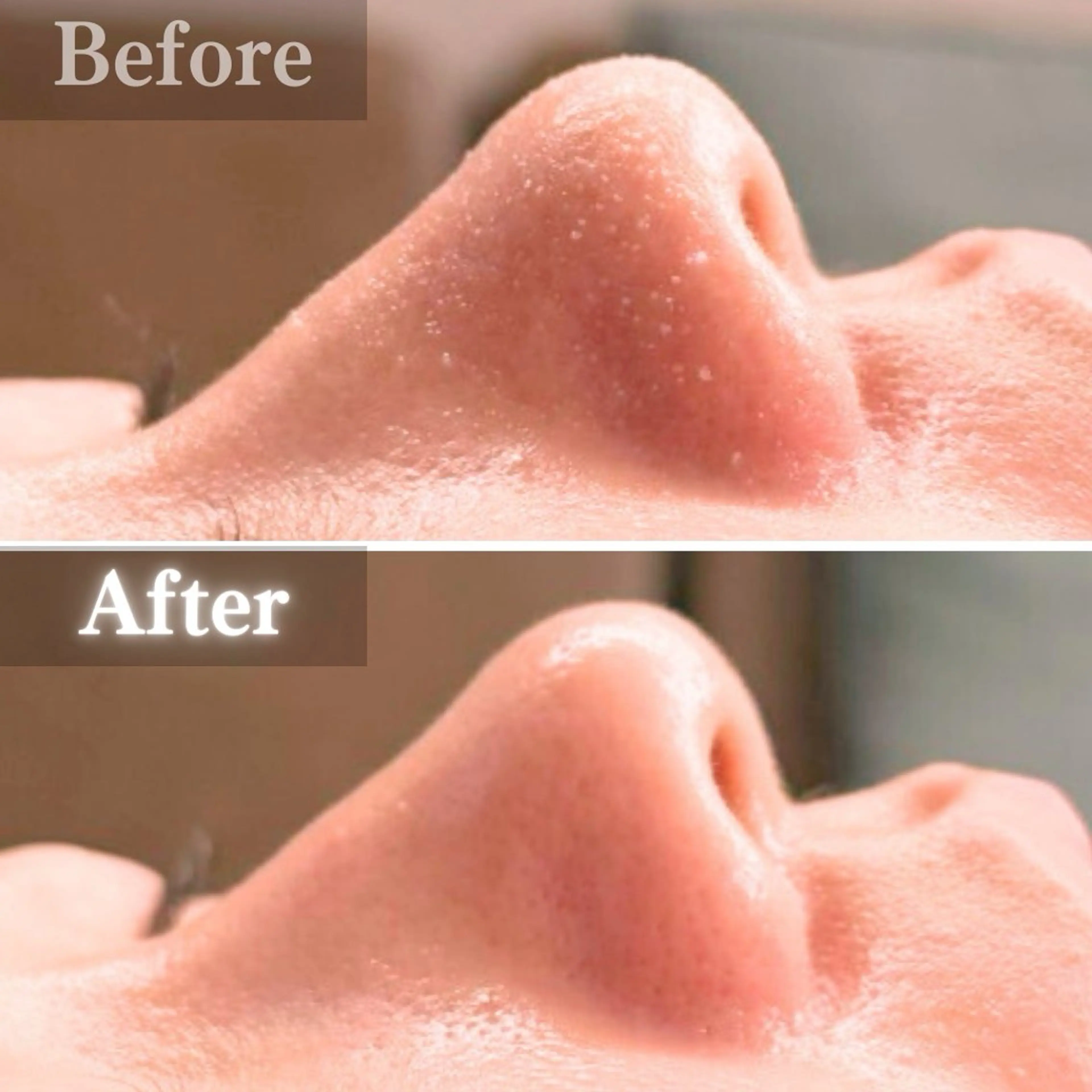 エステ 毛穴洗浄特化🫧 オオツカのエステ・リラクイメージ