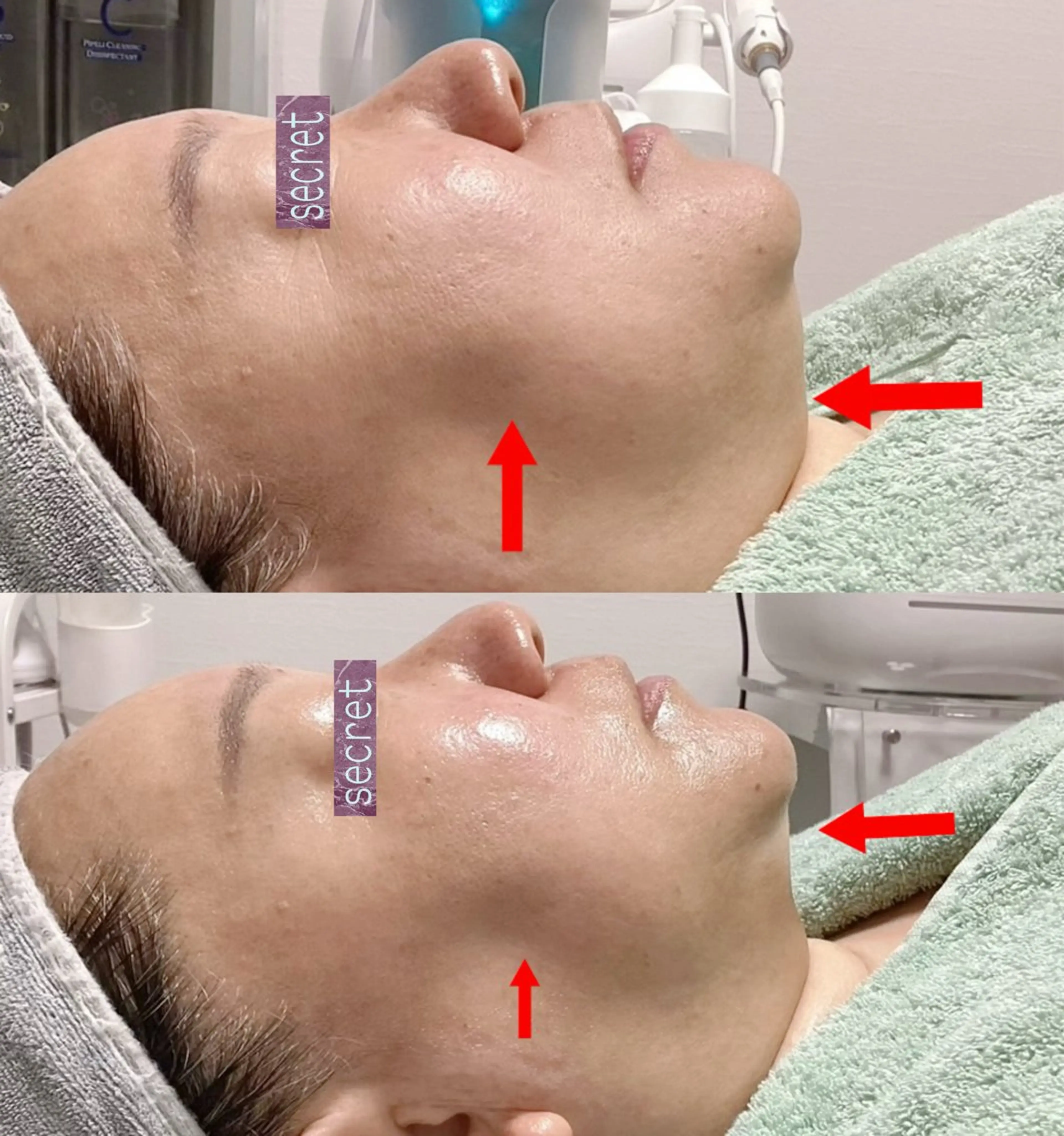 エステ リラク ホワイティアビシェル ウラワ　白澤奇のエステ・リラクイメージ