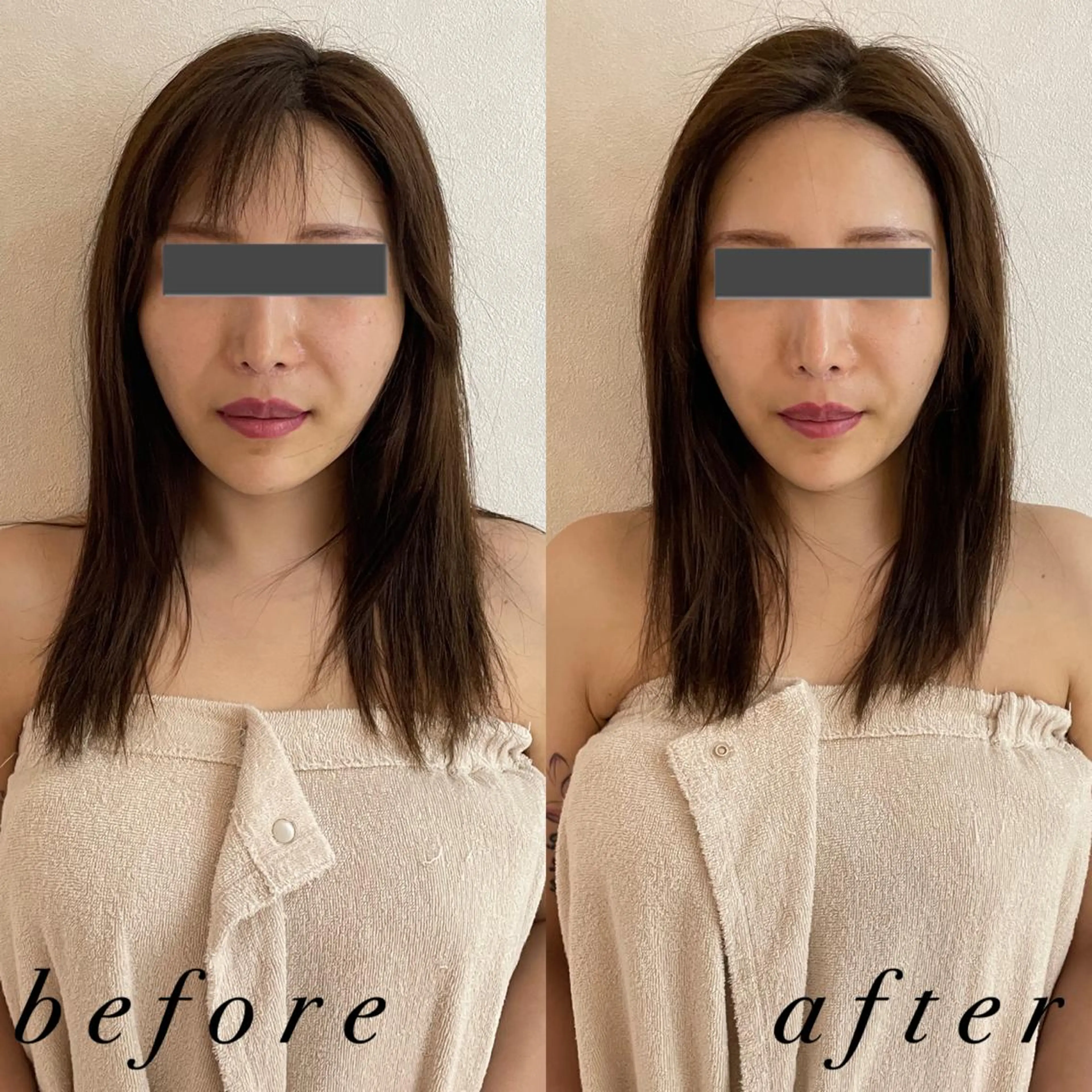 うなじ脱毛/美肌脱毛 LABELのエステ・リラクイメージ