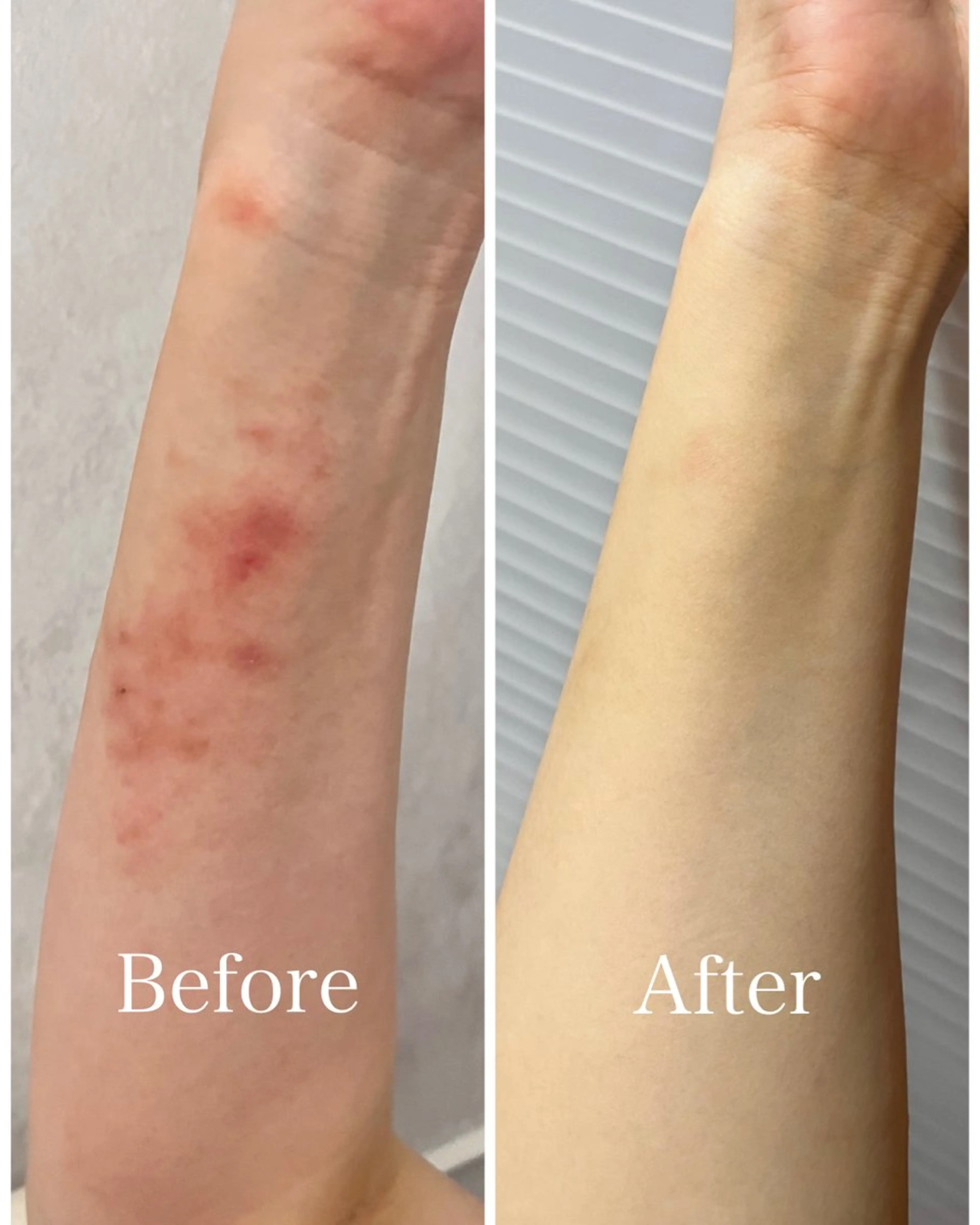 肌のお悩み改善サロン MELIA/朋美のエステ・リラクイメージ