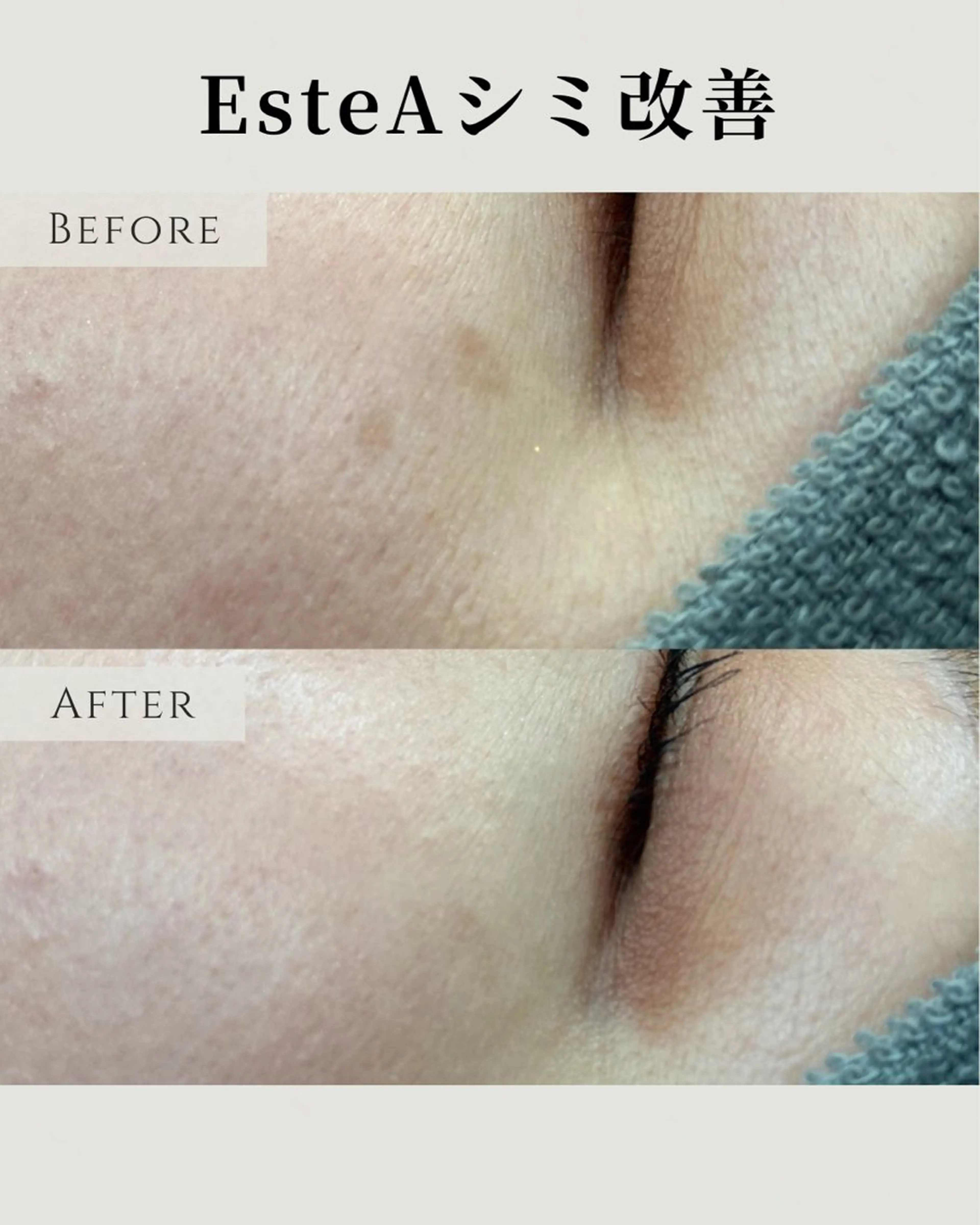 エステ 稲垣 優のエステ・リラクイメージ