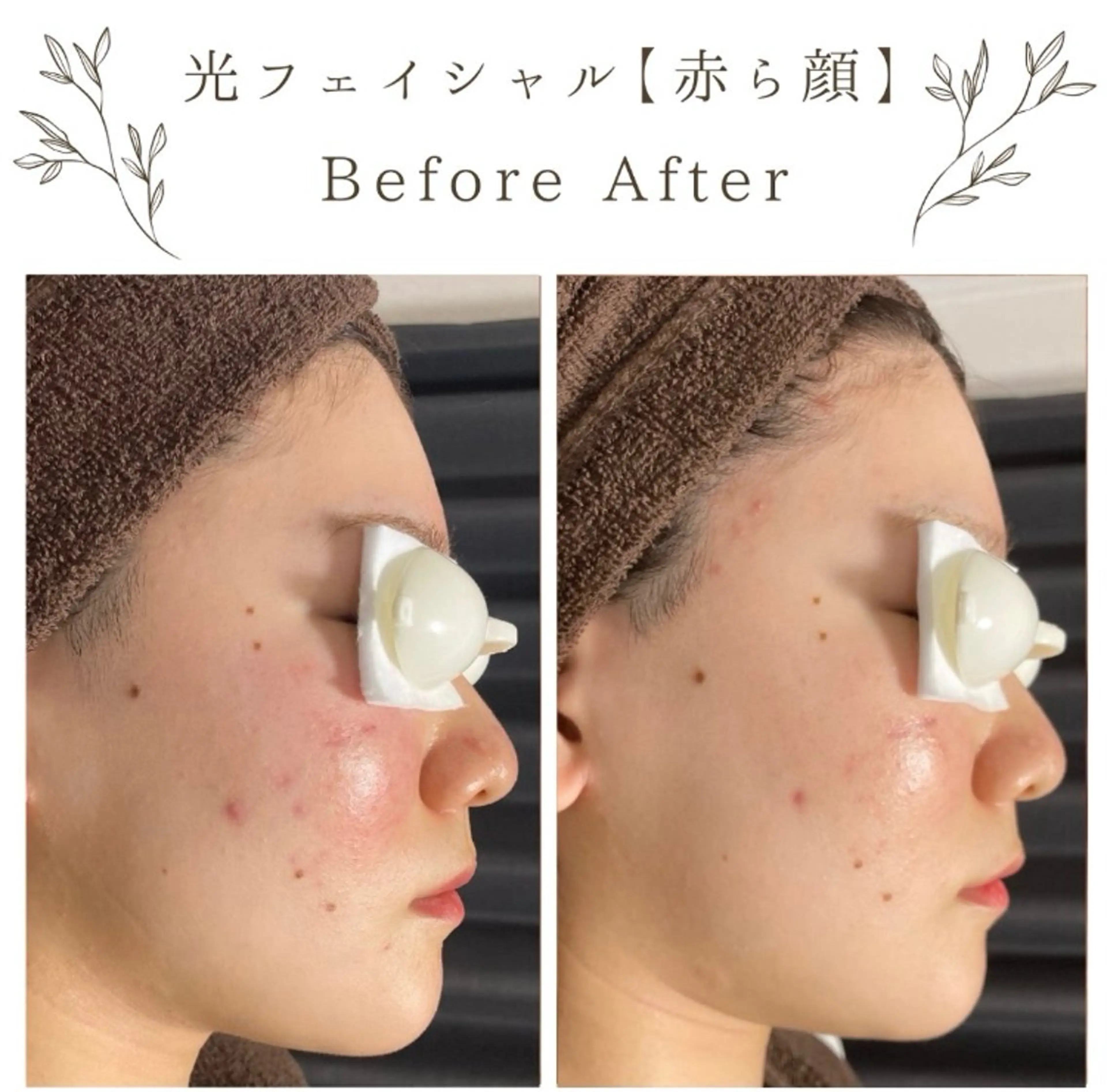 な ぎのエステ・リラクイメージ