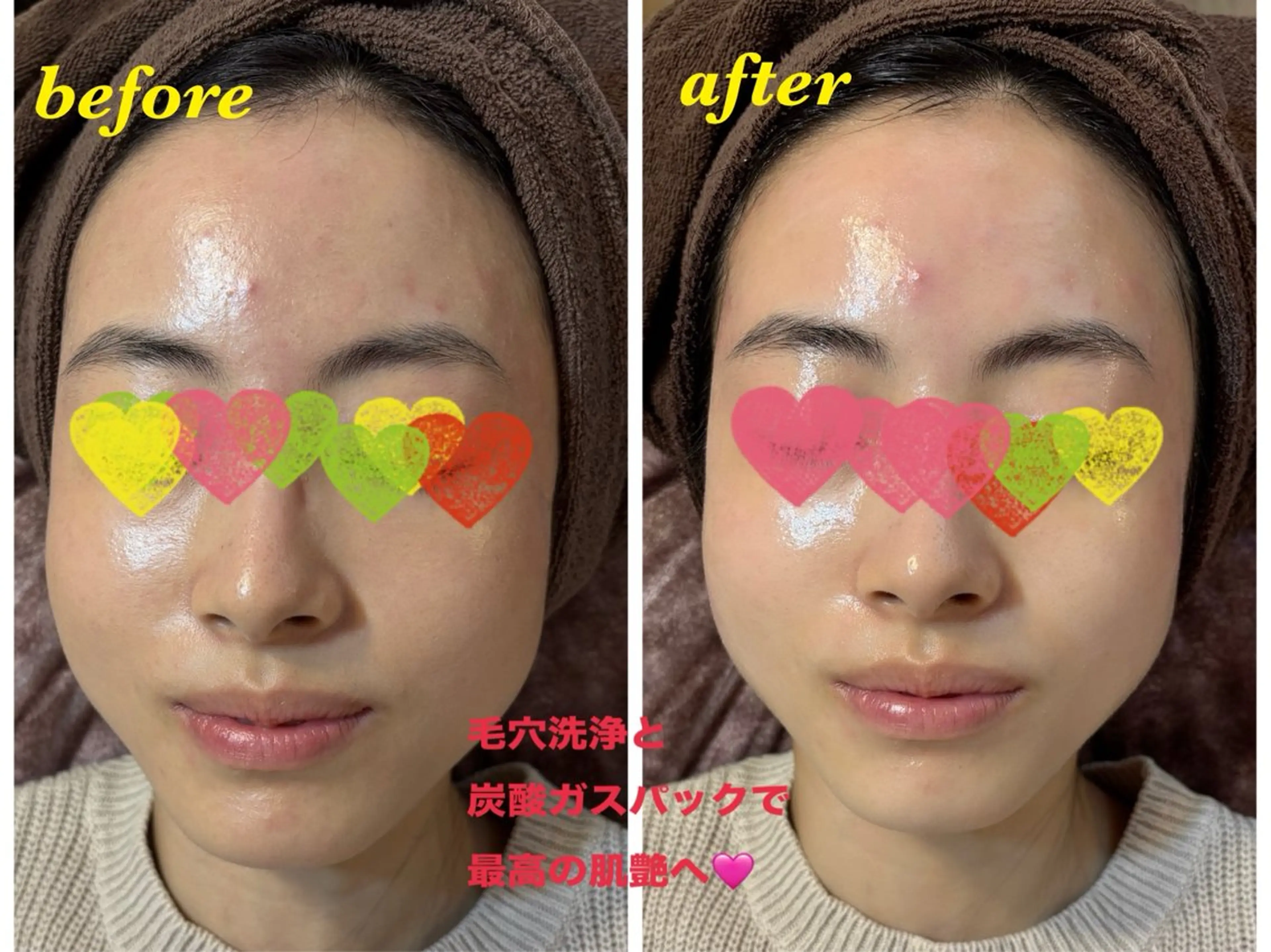 エステ ハーブピーリング専門 毛穴洗浄❤️眉waxのエステ・リラクイメージ