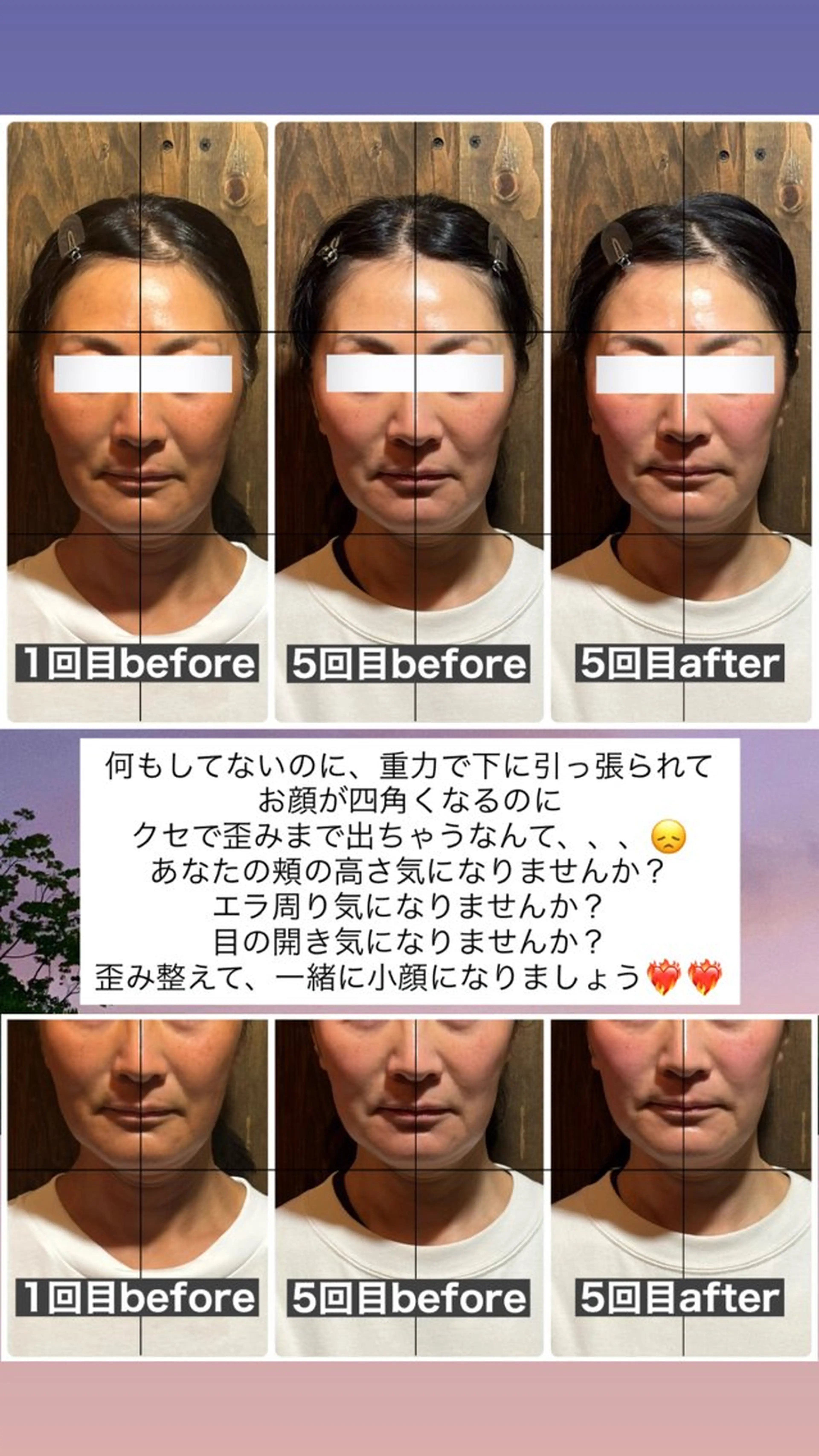 エステ リラク 💎後悔させない小顔 矯正💎イトヤマ🌱のエステ・リラクイメージ