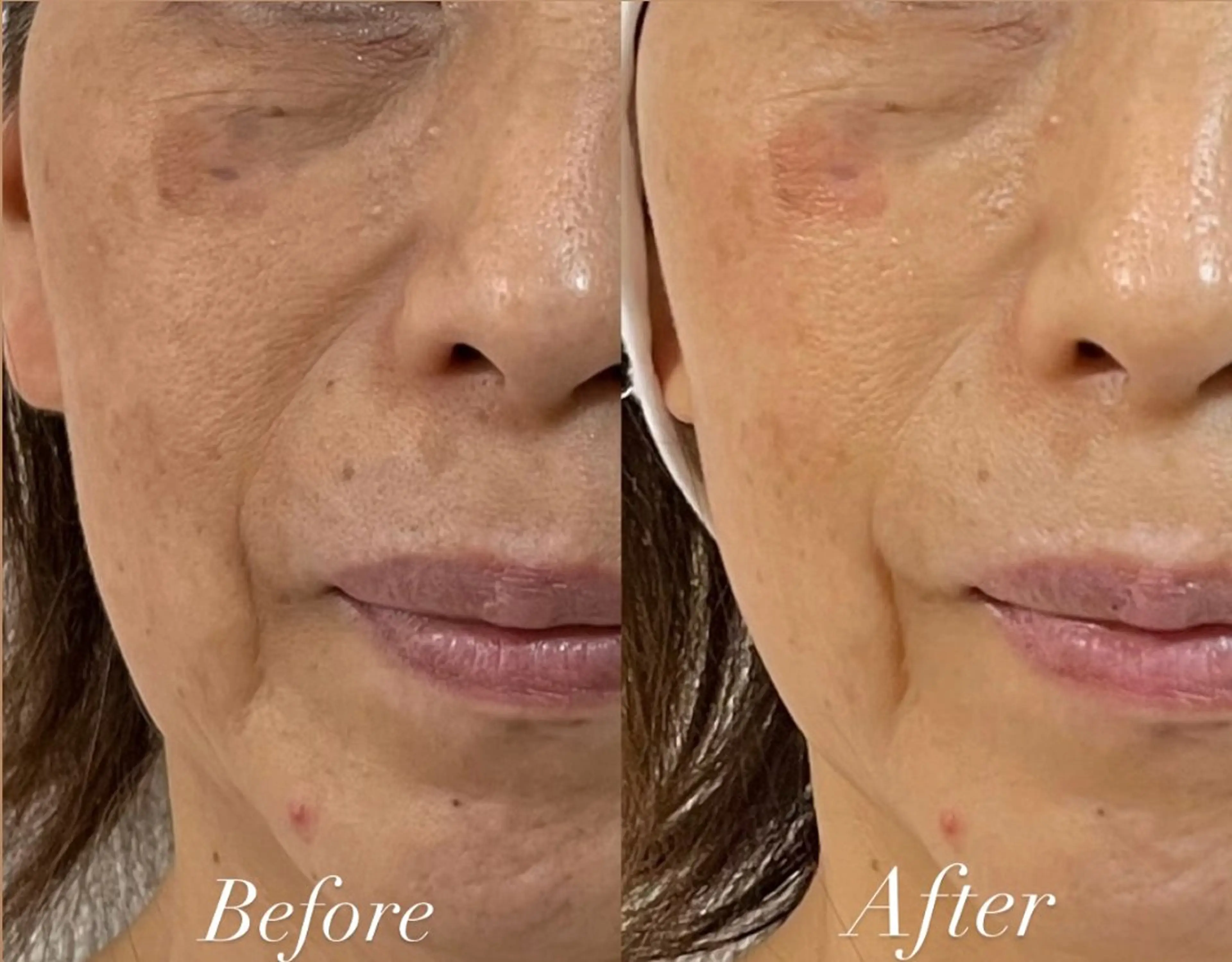 小顔×肌質改善 《お顔の印象》のエステ・リラクイメージ