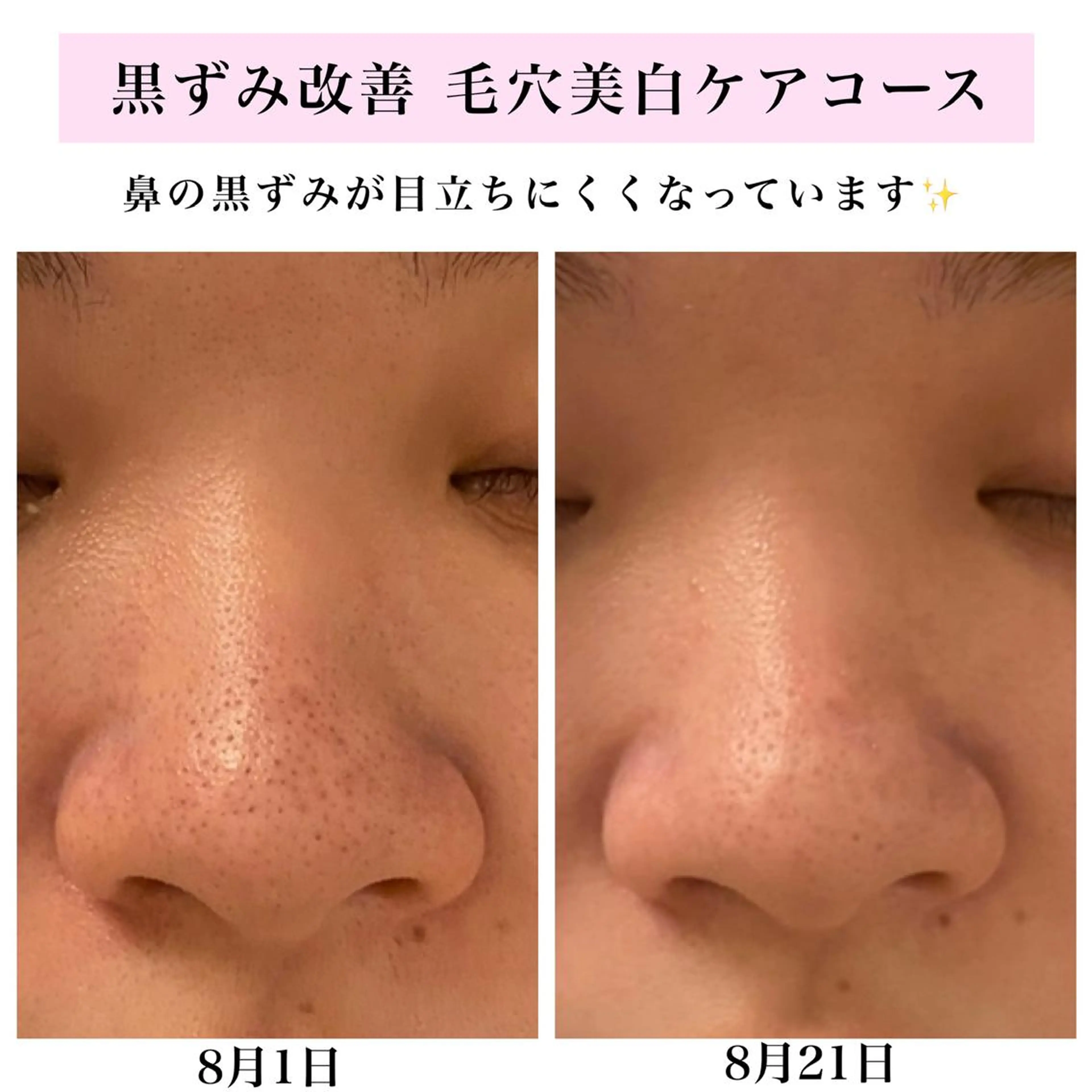 エステ リラク Bellesthe （ベルエステ）のエステ・リラクイメージ