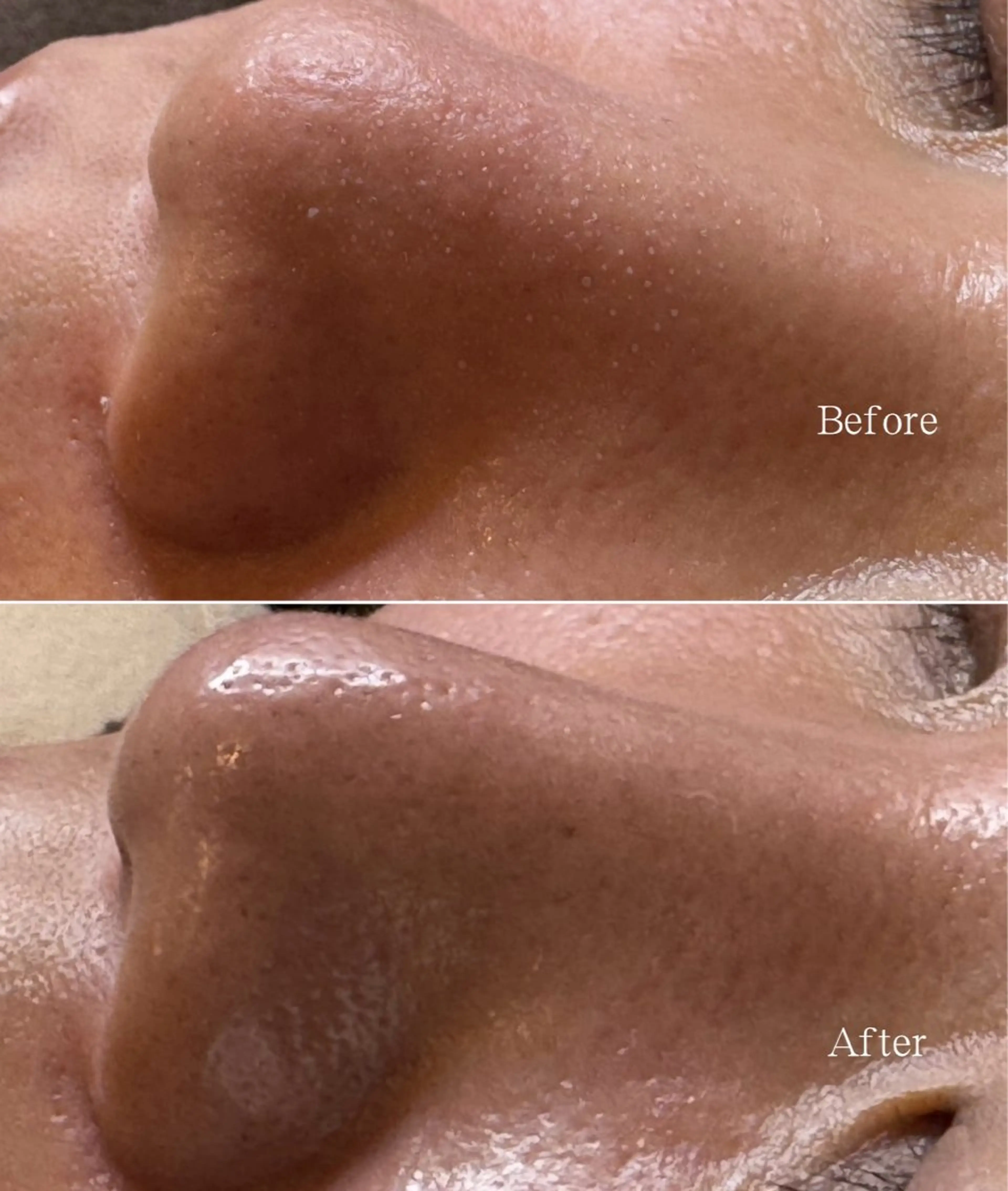 メンズ エステ 新宿大久保美容サロン BELL  マイのその他イメージ